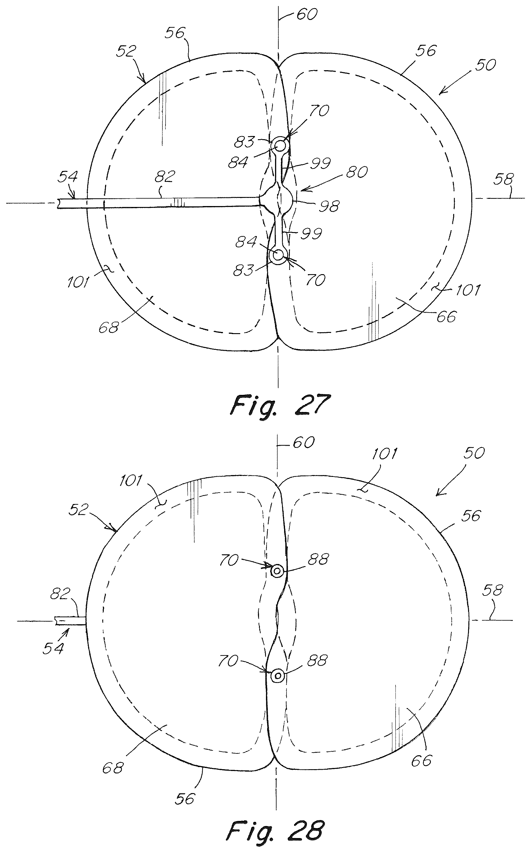 Patent US12102520 Figure 16 – Deployment device for a soft tissue repair prosthesis
