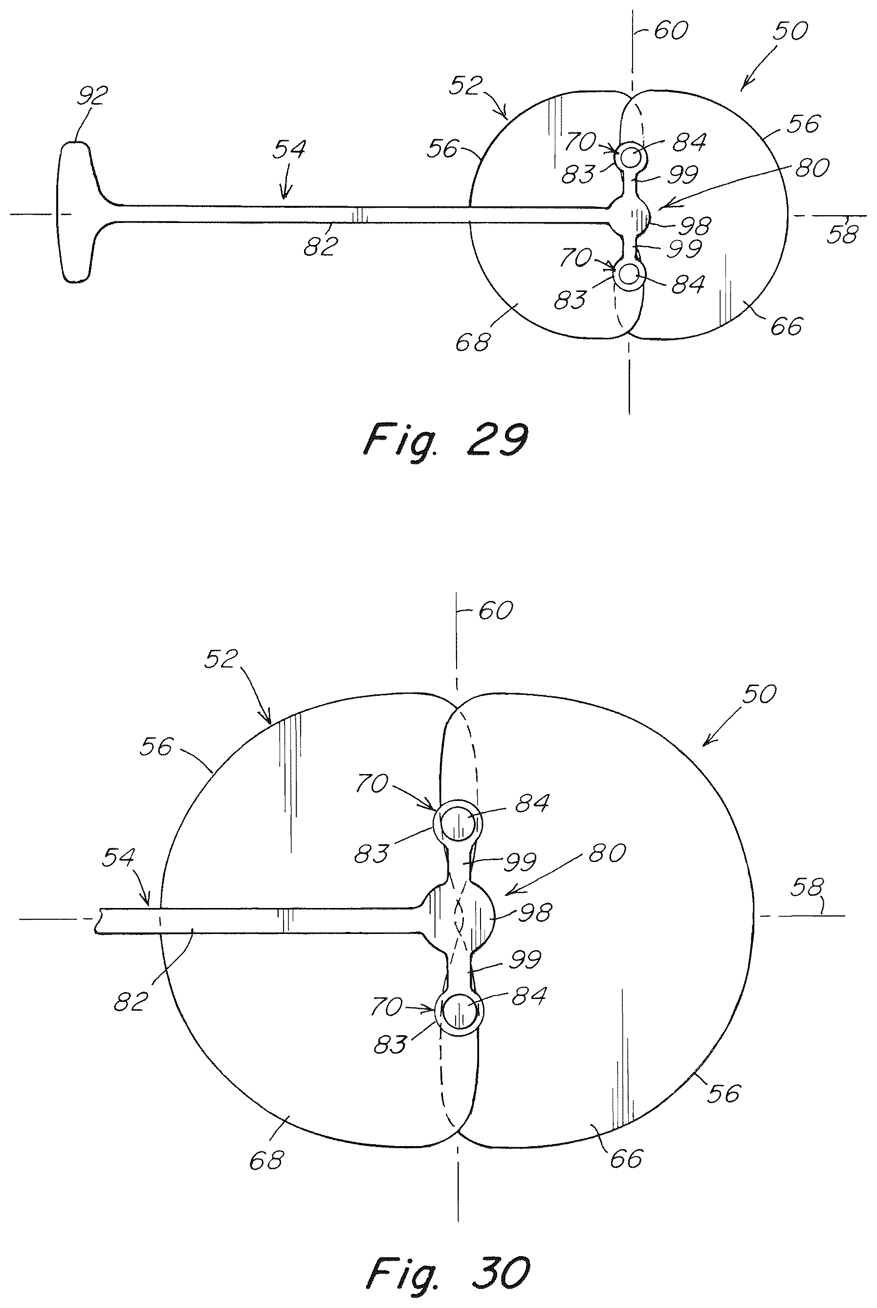 Patent US12102520 Figure 17 – Deployment device for a soft tissue repair prosthesis