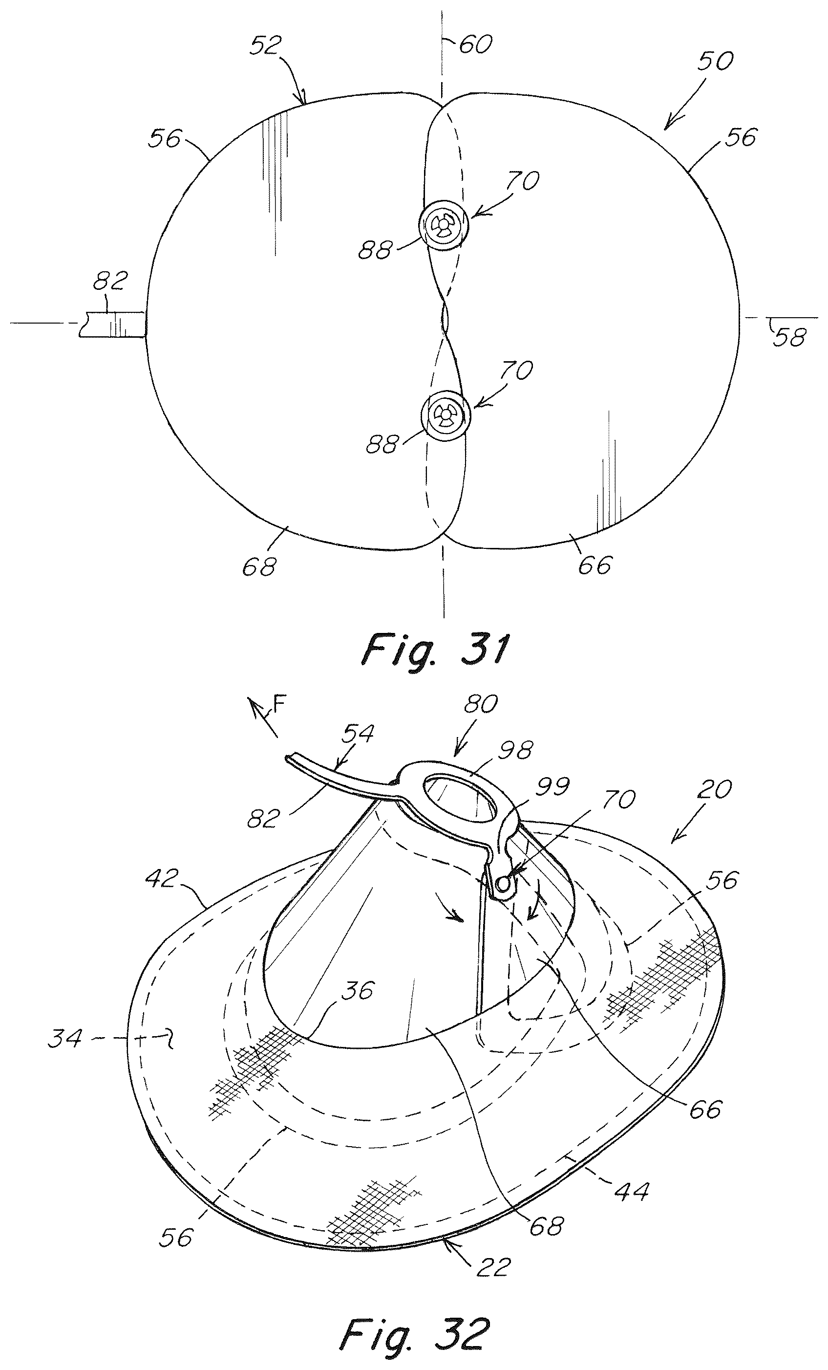 Patent US12102520 Figure 18 – Deployment device for a soft tissue repair prosthesis