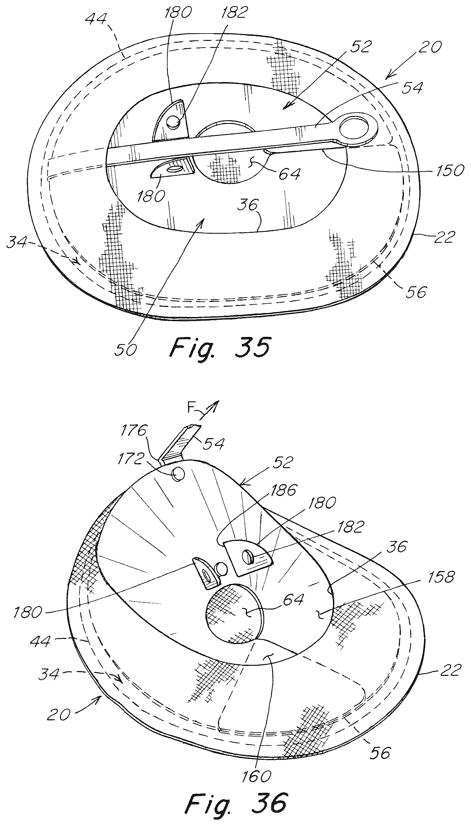 Patent US12102520 Figure 20 – Deployment device for a soft tissue repair prosthesis