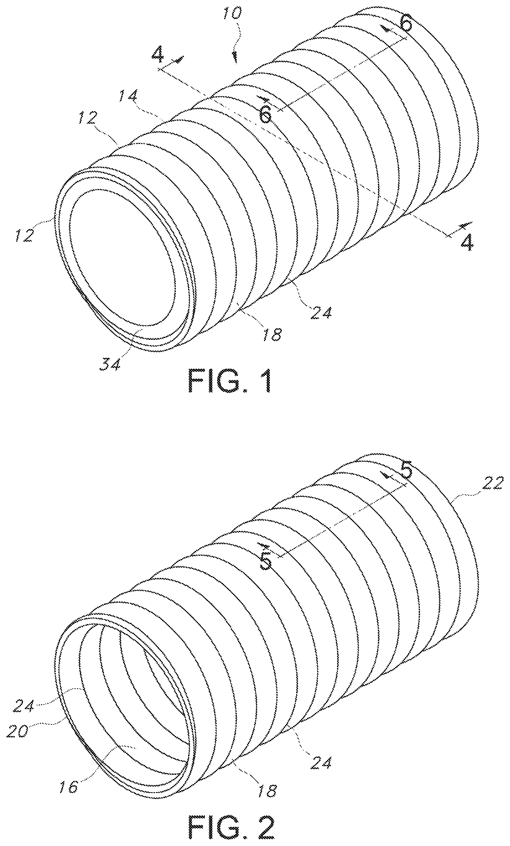 Patent US12102521 Figure 1 – Crimped textile graft with polymer liner
