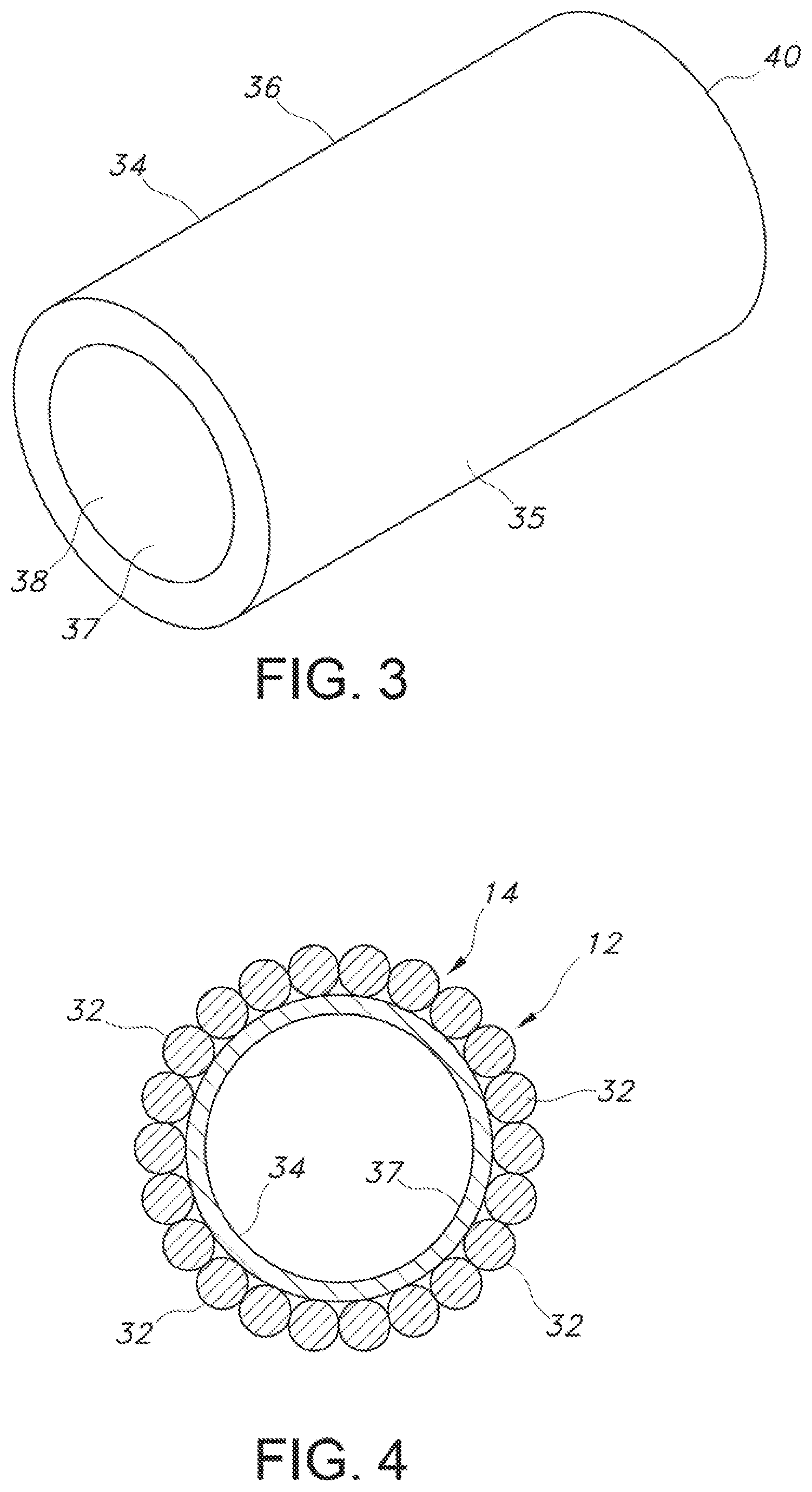 Patent US12102521 Figure 2 – Crimped textile graft with polymer liner