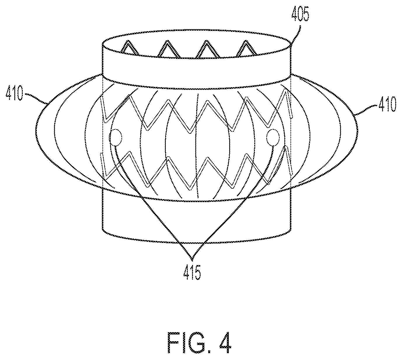 Patent US12102522 Figure 4 – Endovascular stent graft