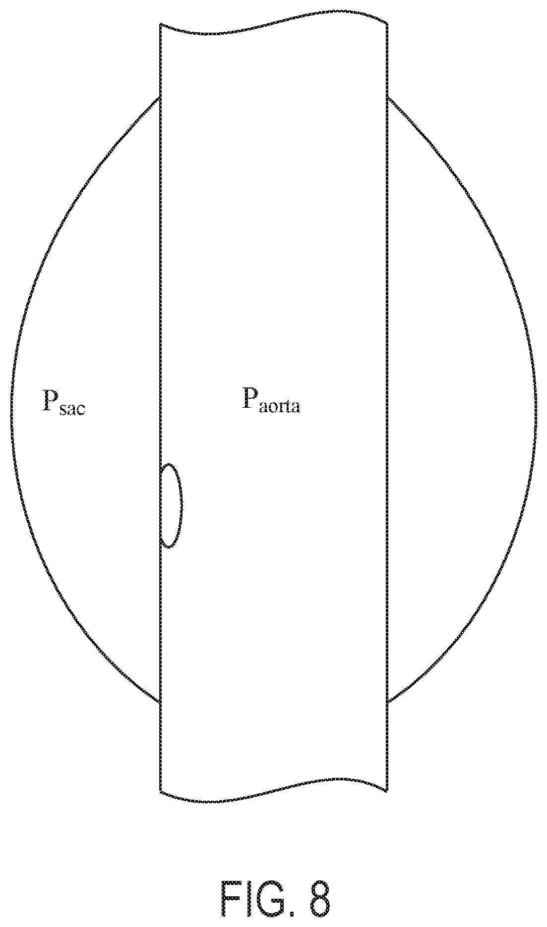Patent US12102522 Figure 8 – Endovascular stent graft