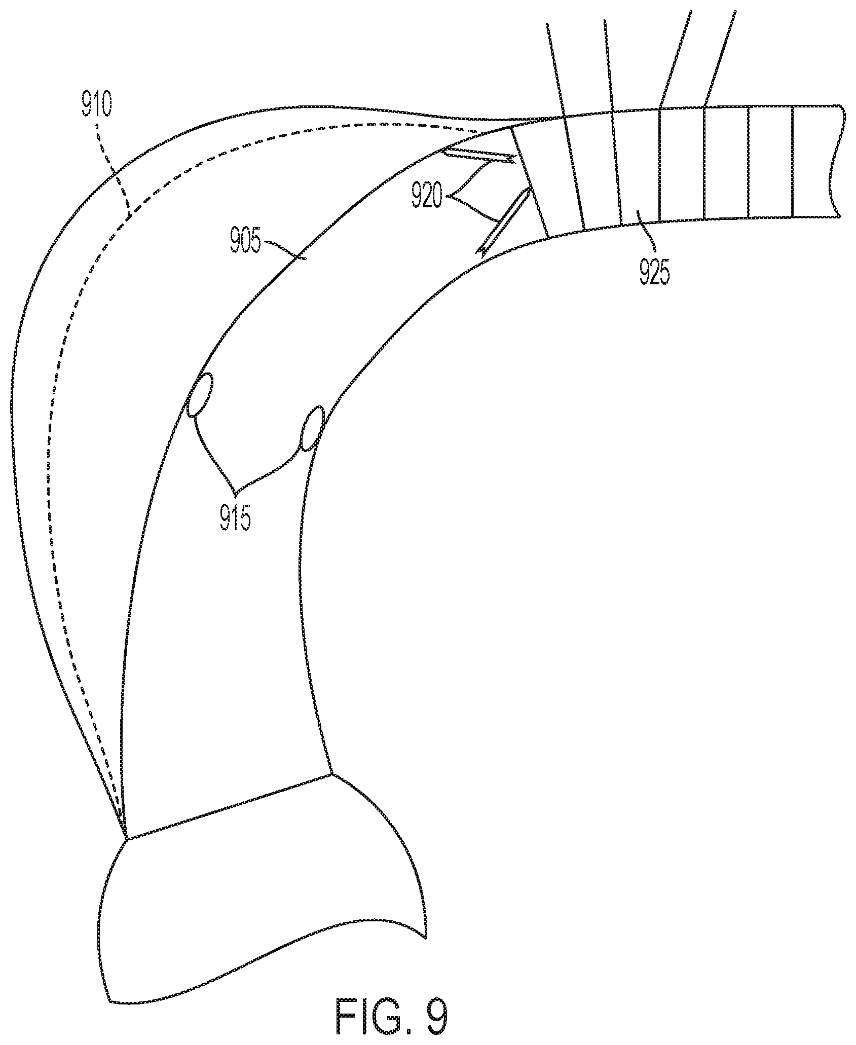 Patent US12102522 Figure 9 – Endovascular stent graft