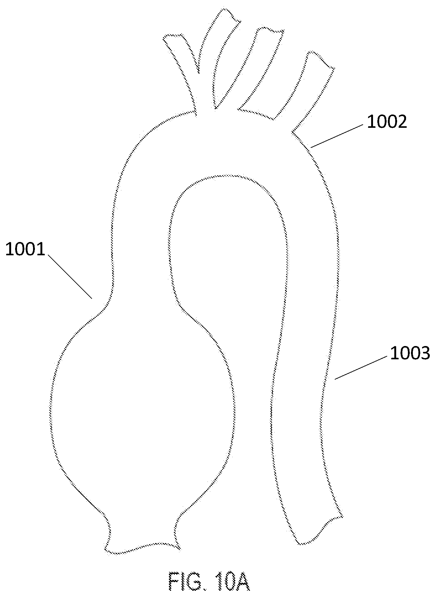 Patent US12102522 Figure 10 – Endovascular stent graft