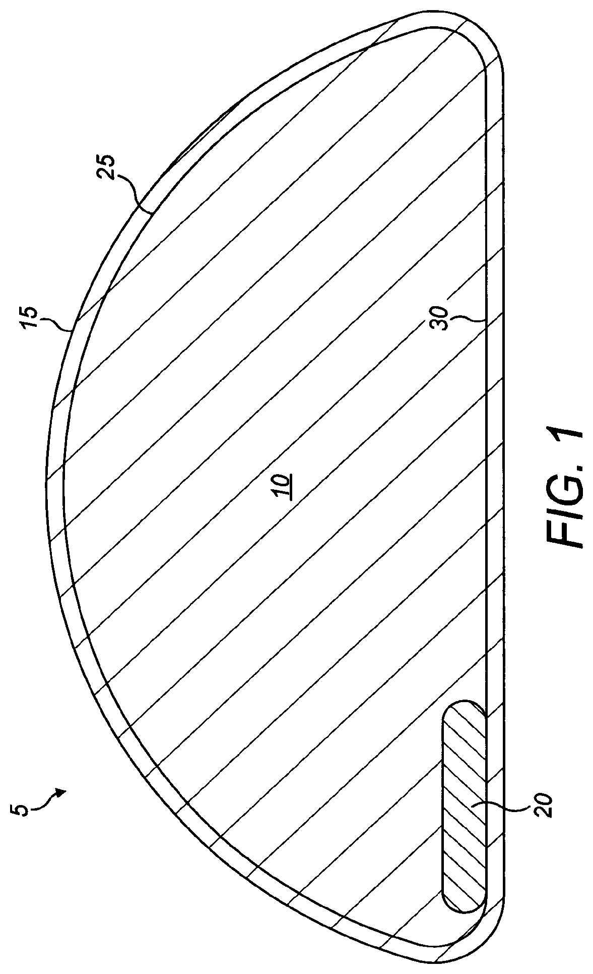 Patent US12102523 Figure 1 – Implant