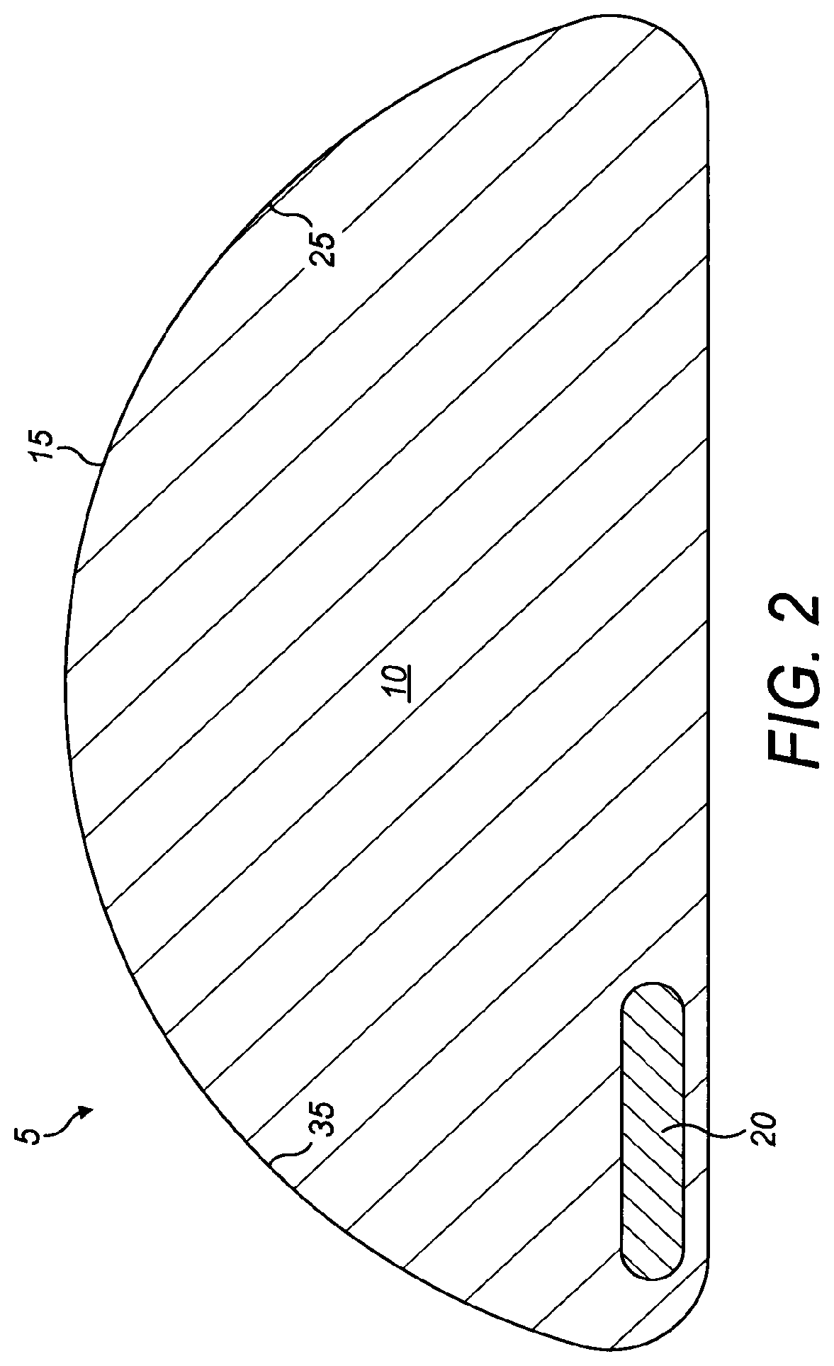 Patent US12102523 Figure 2 – Implant