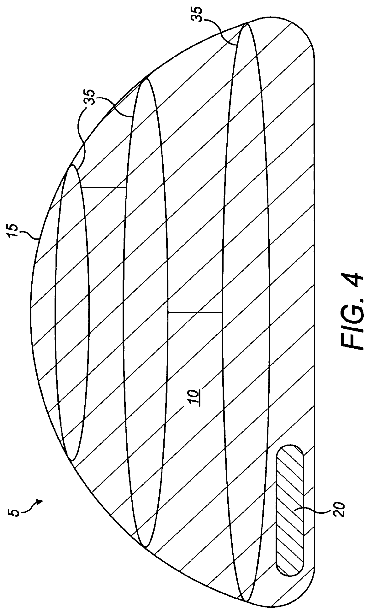 Patent US12102523 Figure 4 – Implant