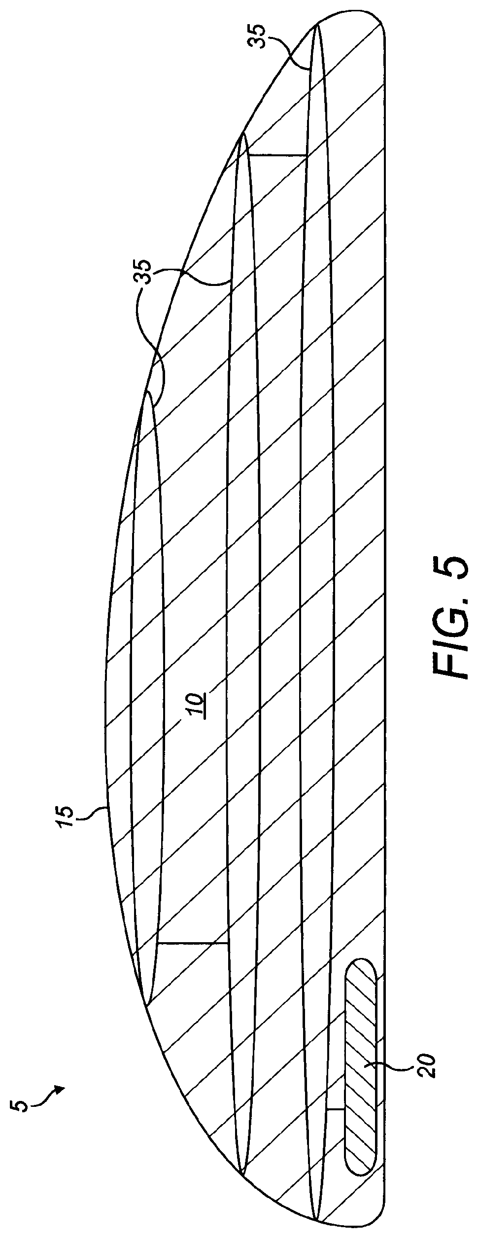 Patent US12102523 Figure 5 – Implant