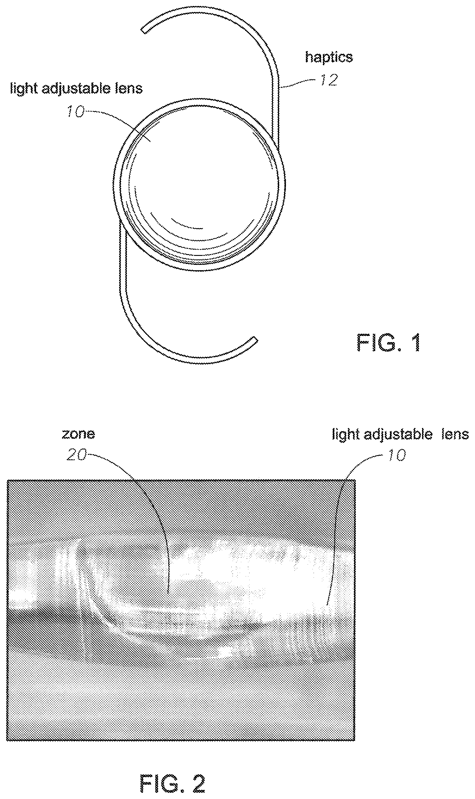 Patent US12102524 Figure 1 – Light adjustable intraocular lens with a modulable absorption front protection layer