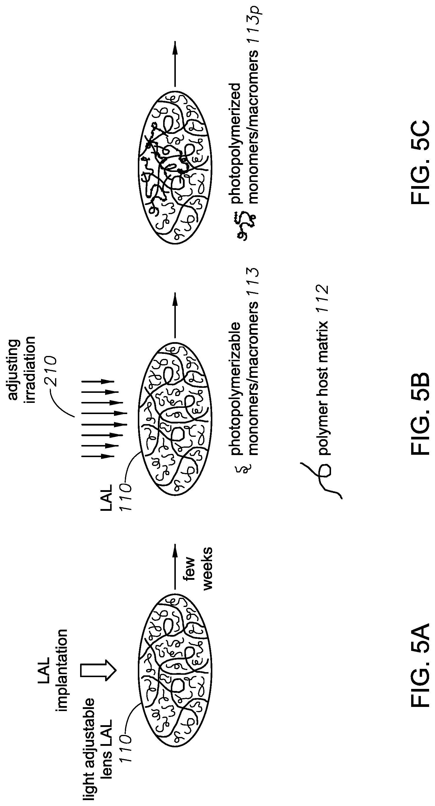 Patent US12102524 Figure 6 – Light adjustable intraocular lens with a modulable absorption front protection layer