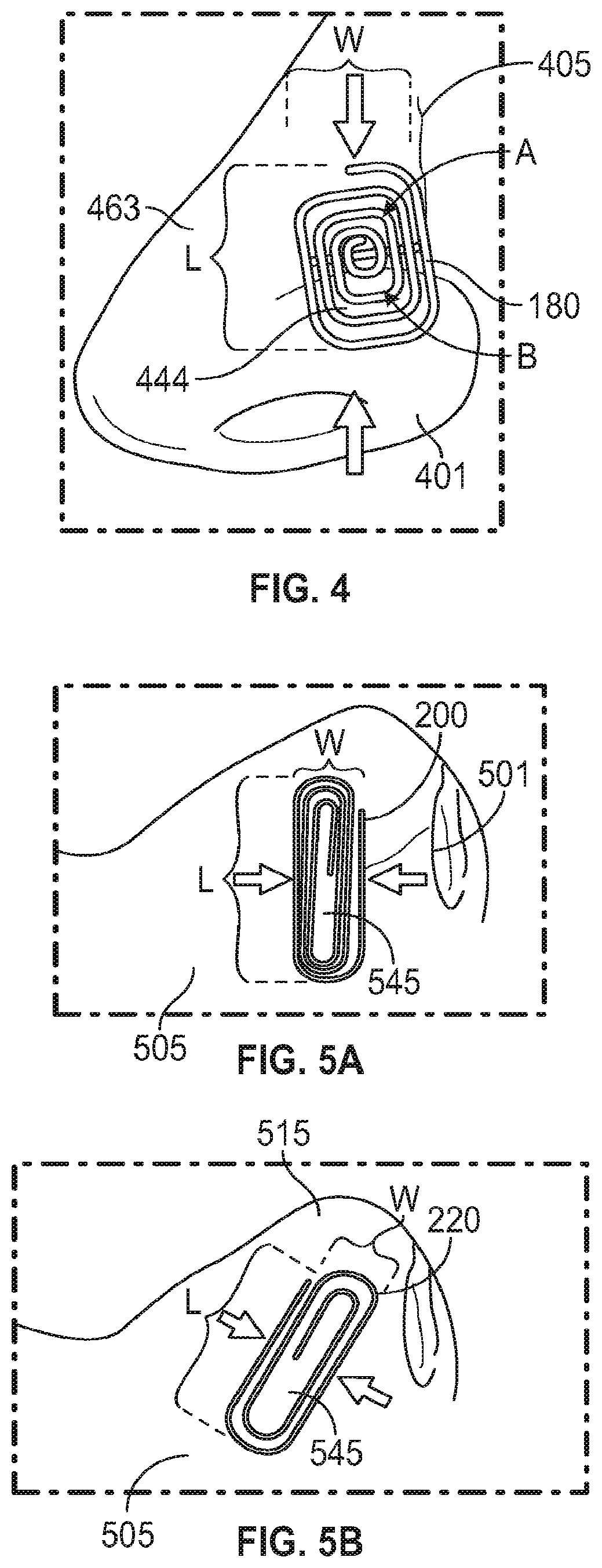 Patent US12102525 Figure 3 – Nasal implants, delivery tools, systems, and methods of use