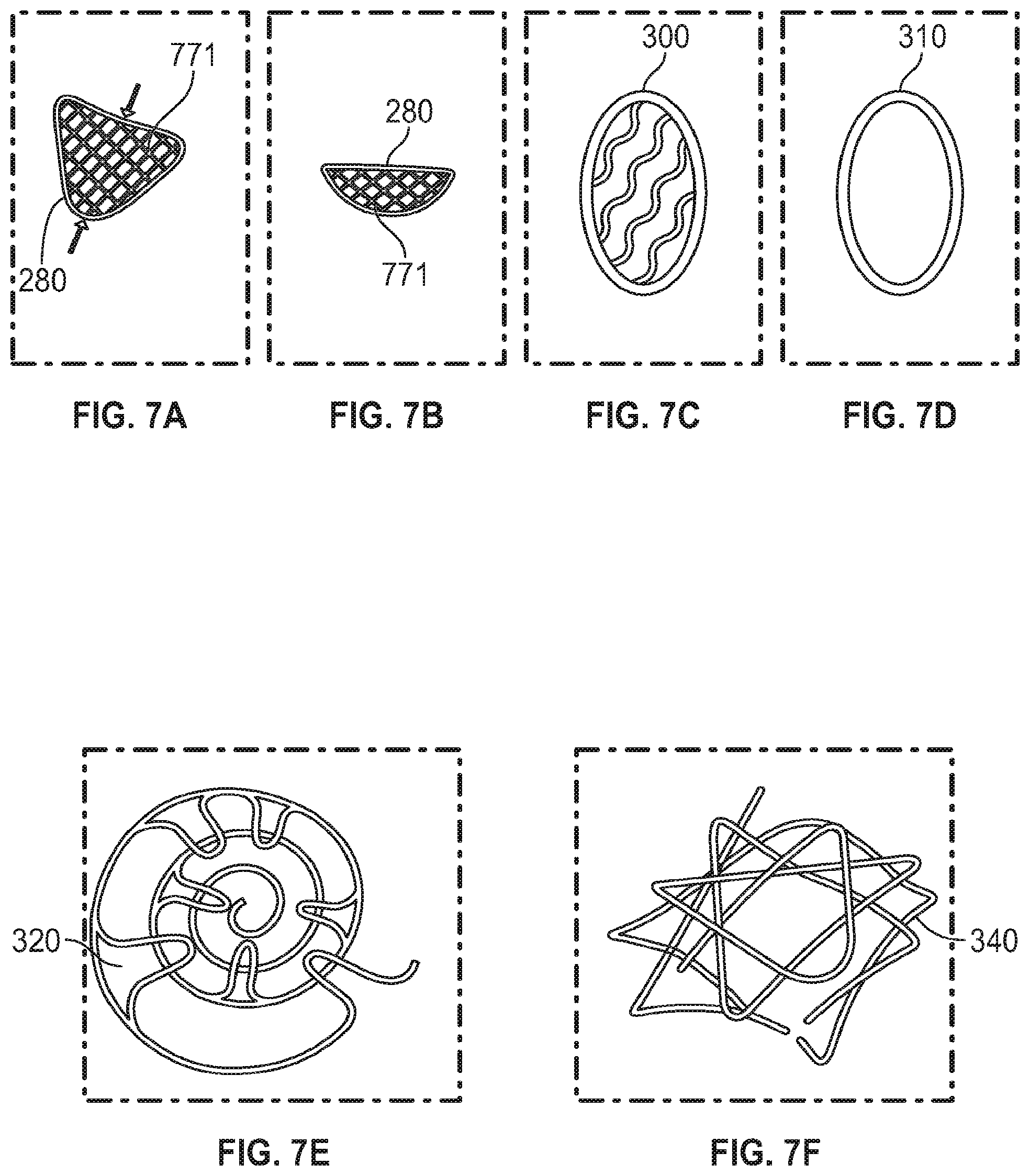 Patent US12102525 Figure 5 – Nasal implants, delivery tools, systems, and methods of use