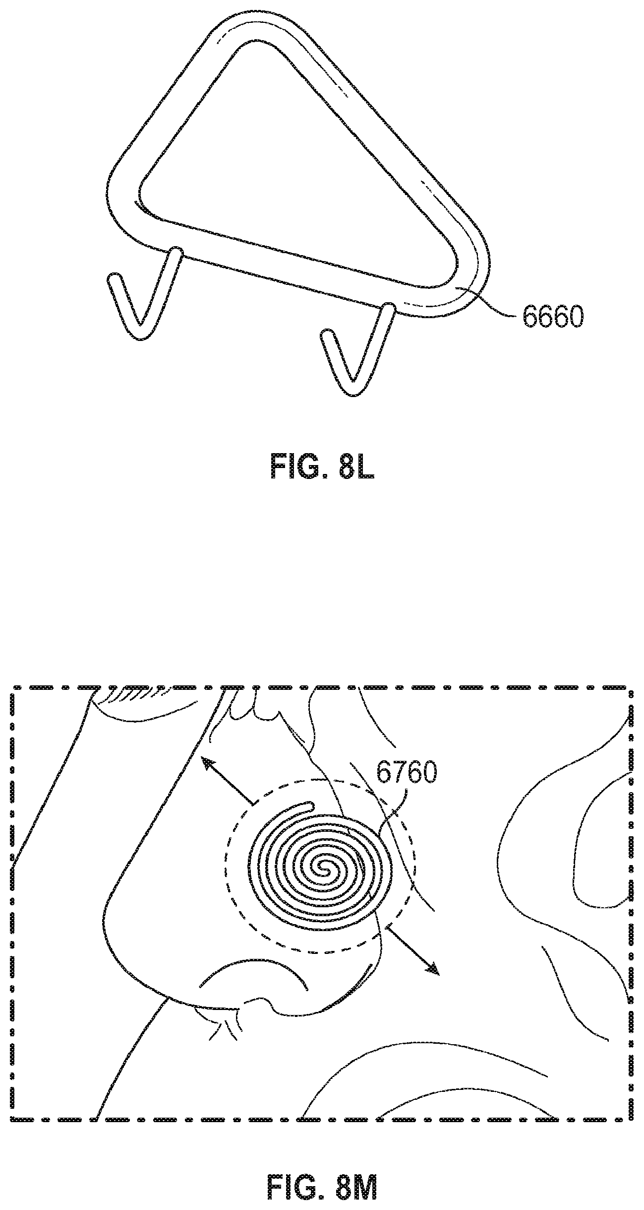 Patent US12102525 Figure 7 – Nasal implants, delivery tools, systems, and methods of use