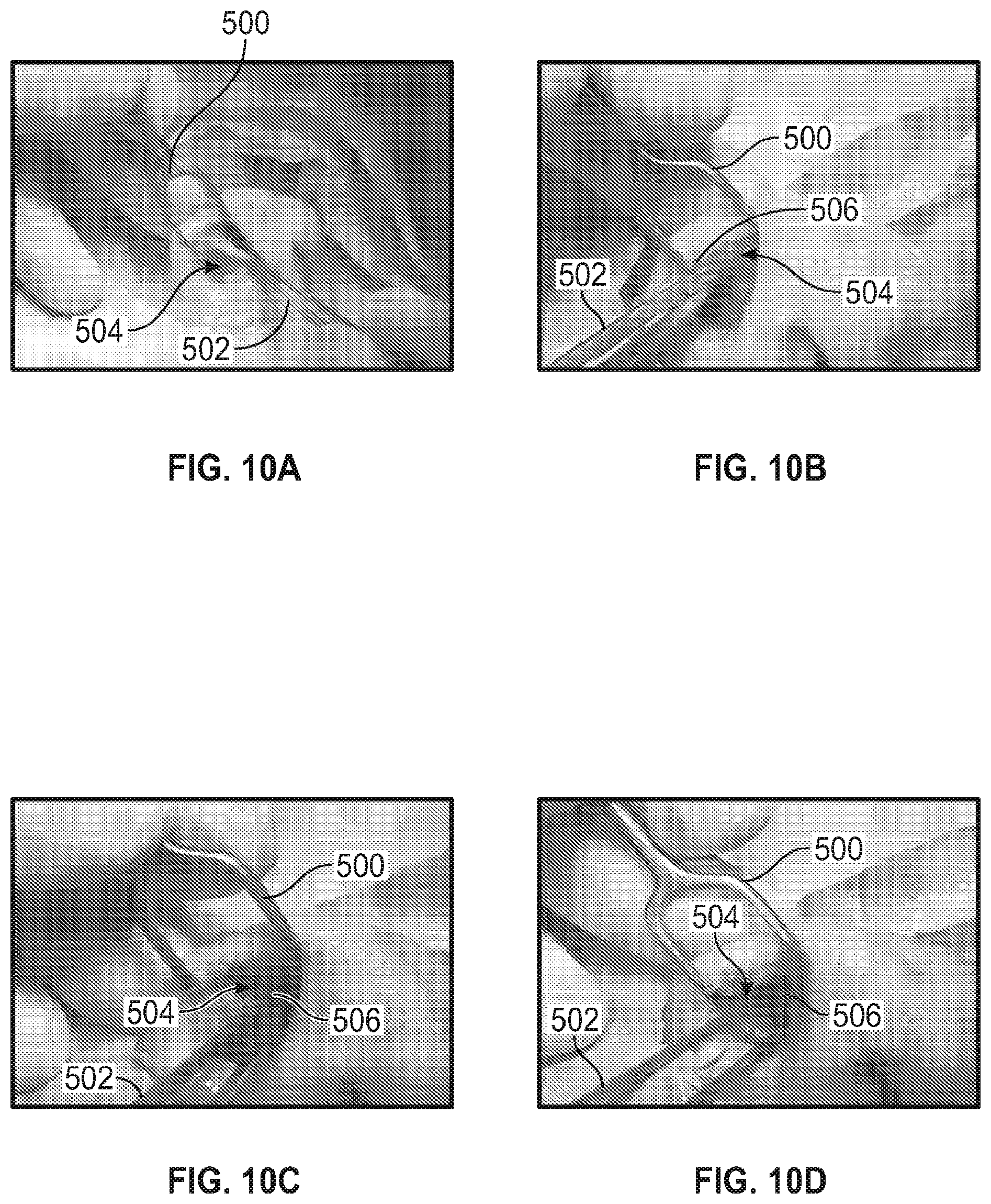 Patent US12102525 Figure 9 – Nasal implants, delivery tools, systems, and methods of use