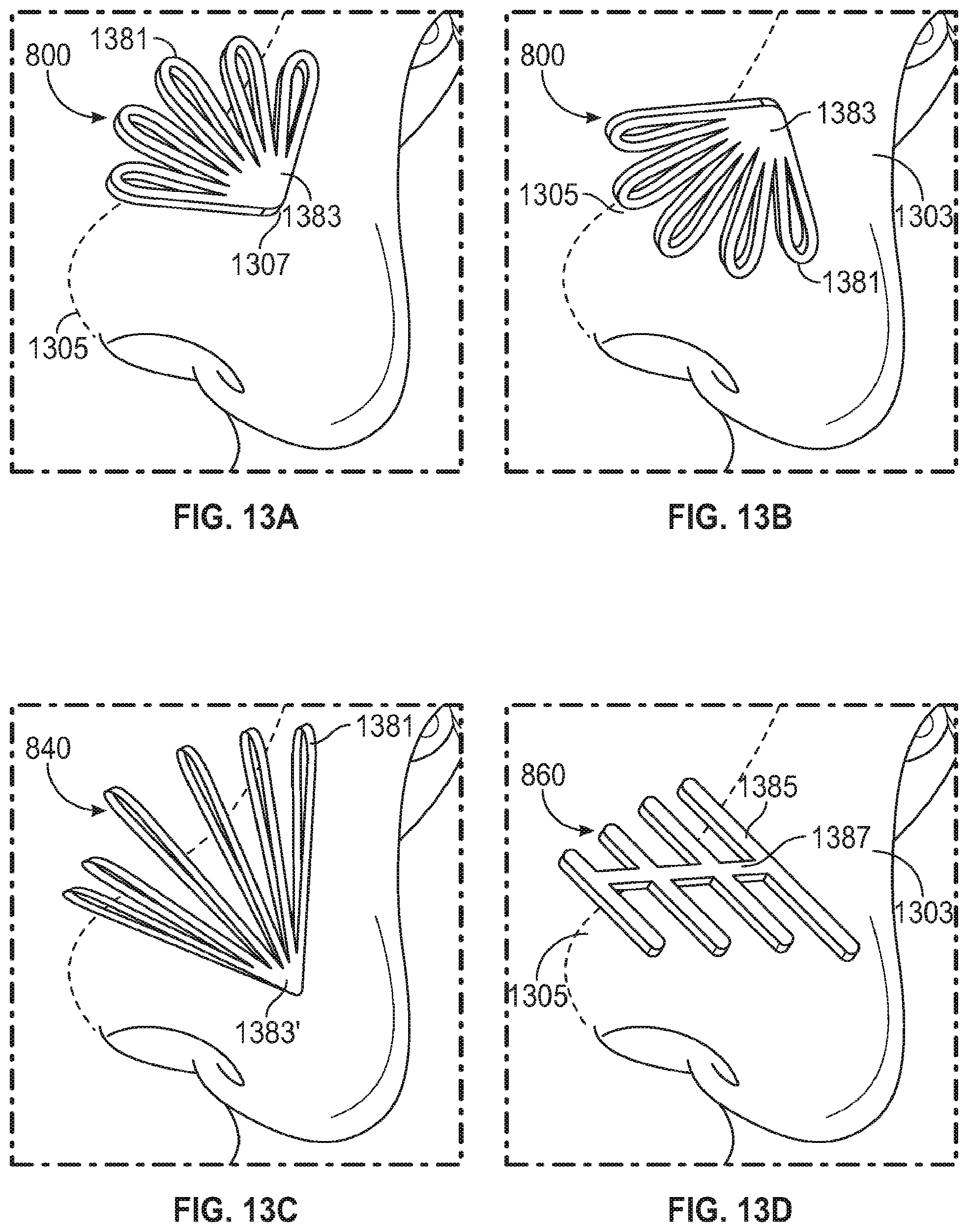Patent US12102525 Figure 12 – Nasal implants, delivery tools, systems, and methods of use