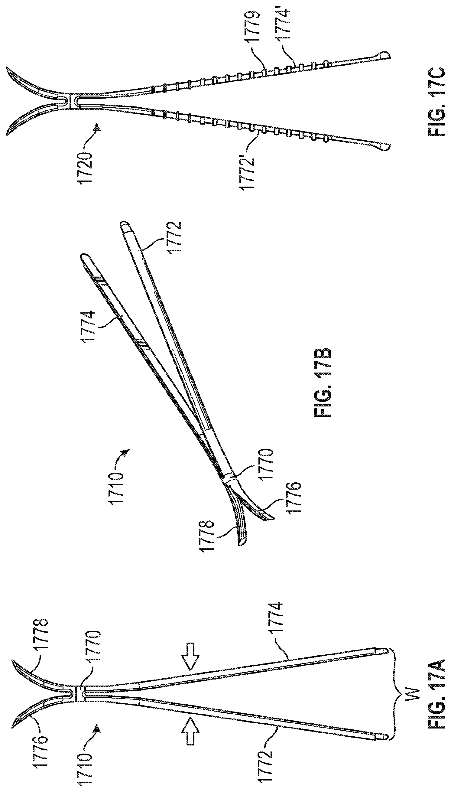 Patent US12102525 Figure 14 – Nasal implants, delivery tools, systems, and methods of use