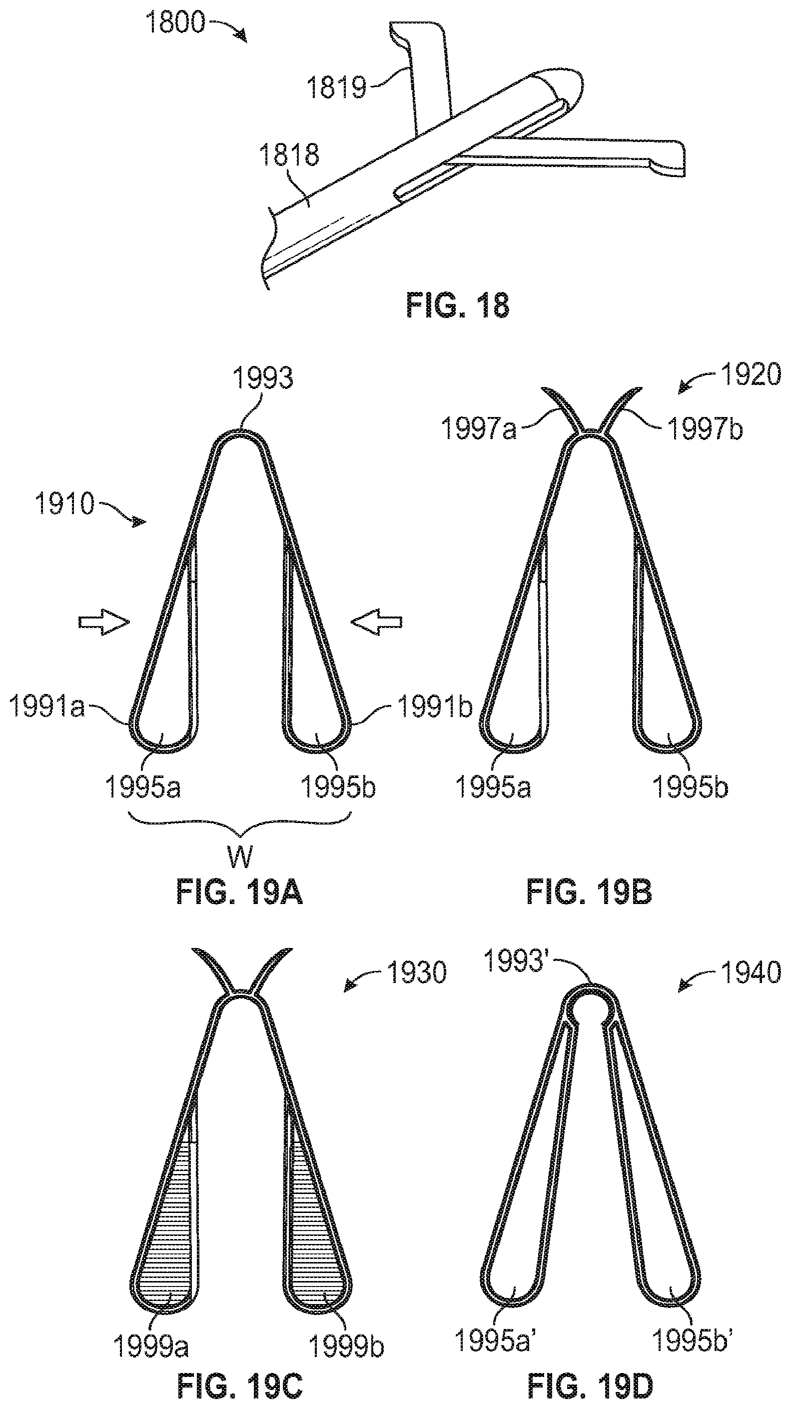 Patent US12102525 Figure 17 – Nasal implants, delivery tools, systems, and methods of use
