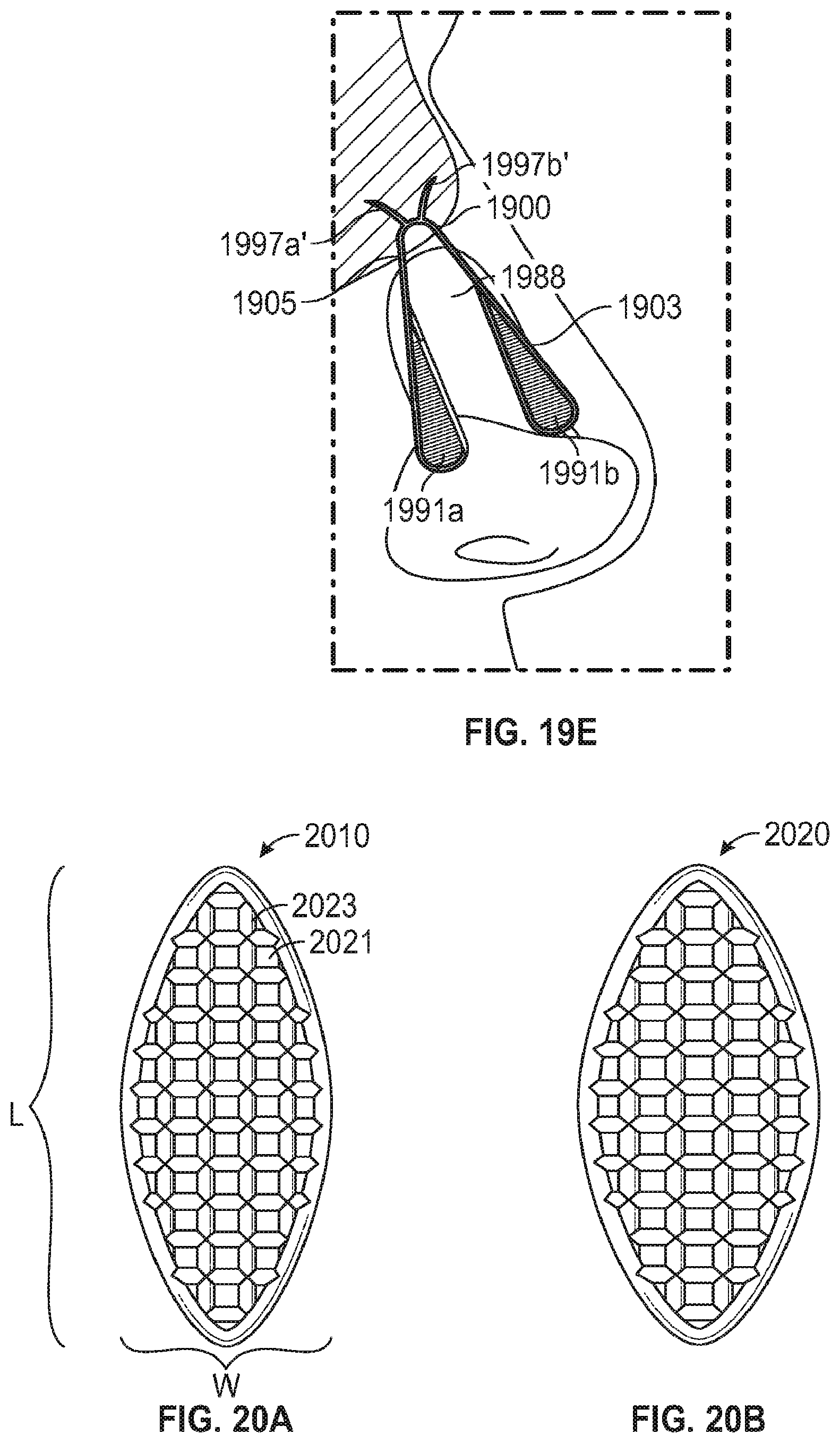 Patent US12102525 Figure 18 – Nasal implants, delivery tools, systems, and methods of use