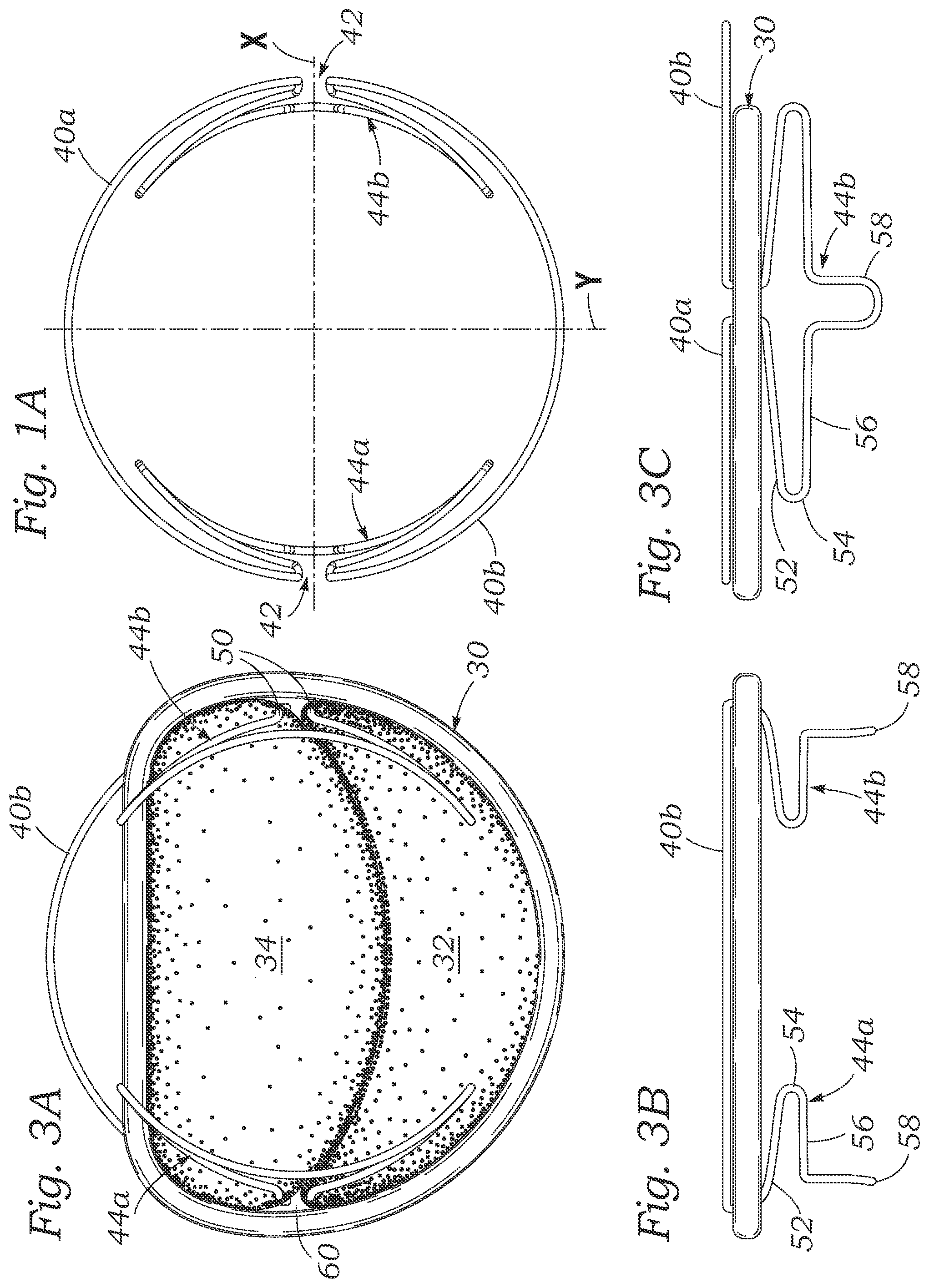 Patent US12102526 Figure 2 – Docking station for heart valve prosthesis