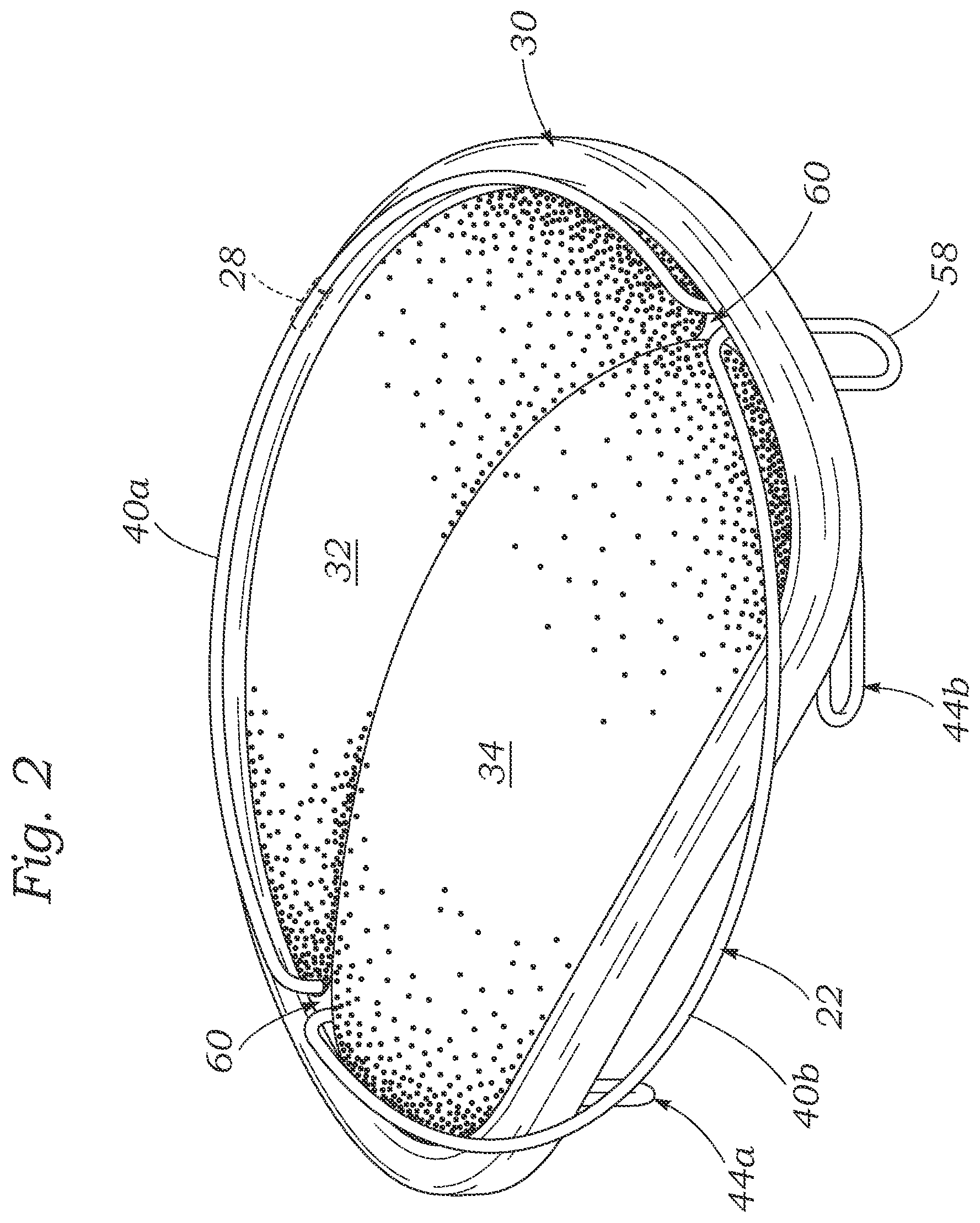 Patent US12102526 Figure 3 – Docking station for heart valve prosthesis