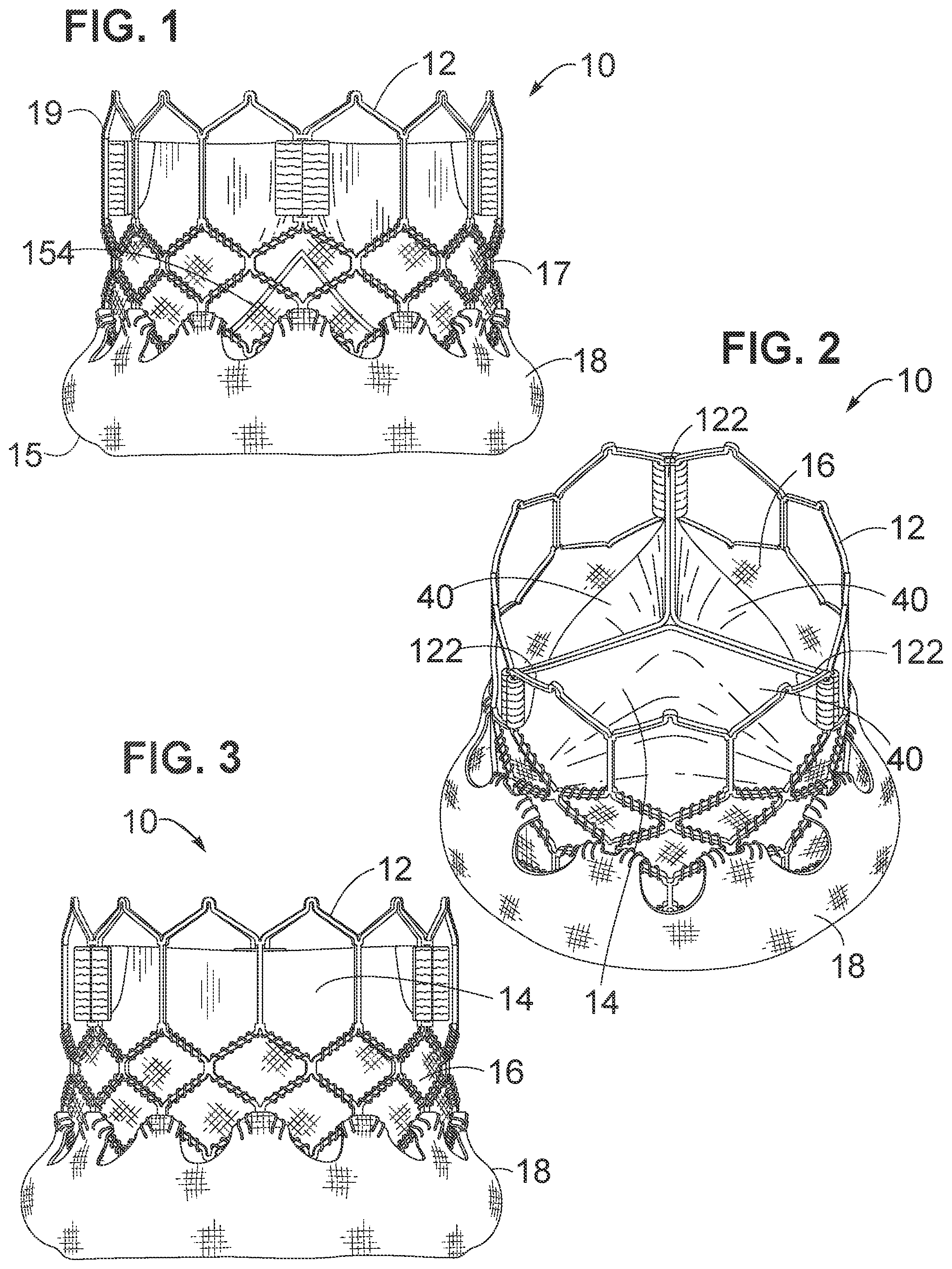 Patent US12102528 Figure 1 – Prosthetic heart valve