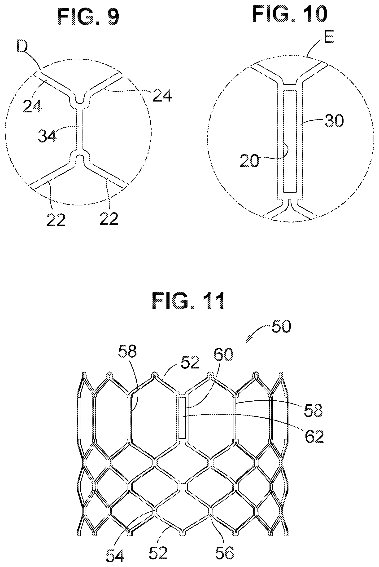 Patent US12102528 Figure 3 – Prosthetic heart valve