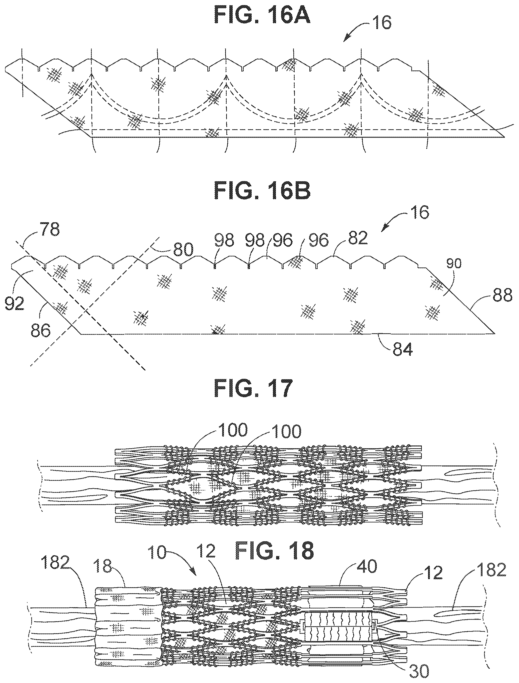 Patent US12102528 Figure 5 – Prosthetic heart valve