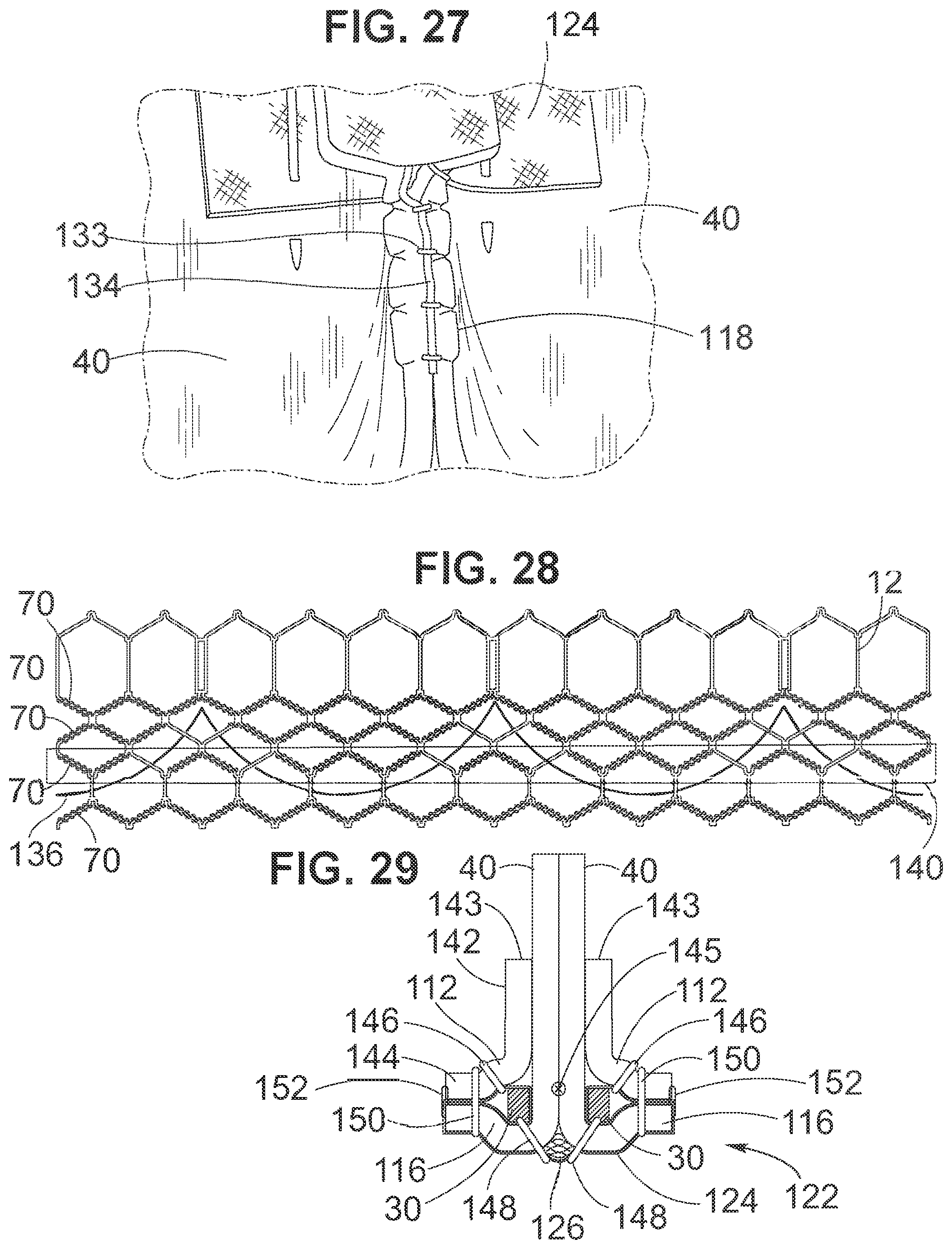 Patent US12102528 Figure 9 – Prosthetic heart valve