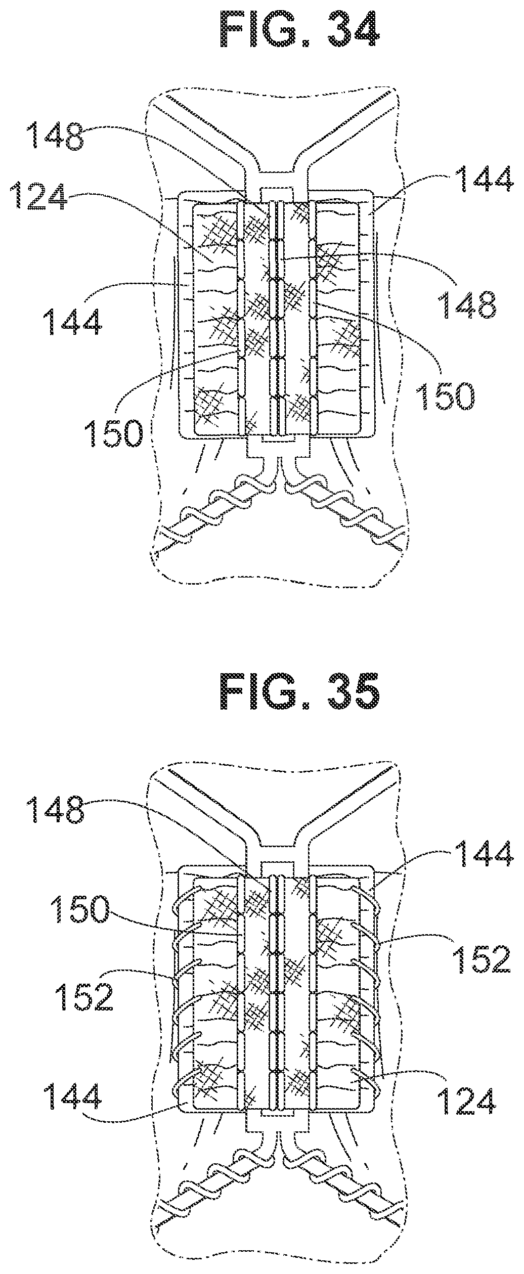 Patent US12102528 Figure 12 – Prosthetic heart valve