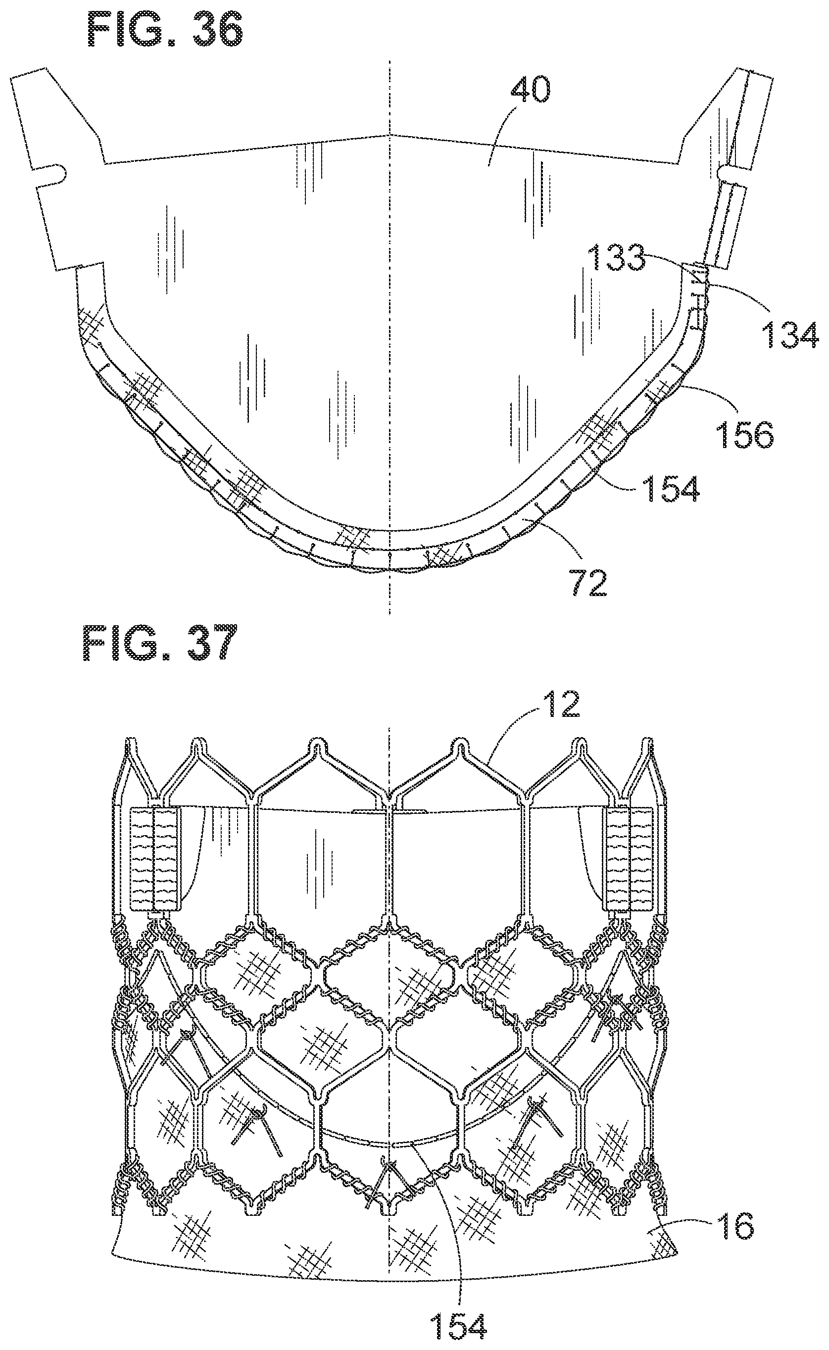 Patent US12102528 Figure 13 – Prosthetic heart valve