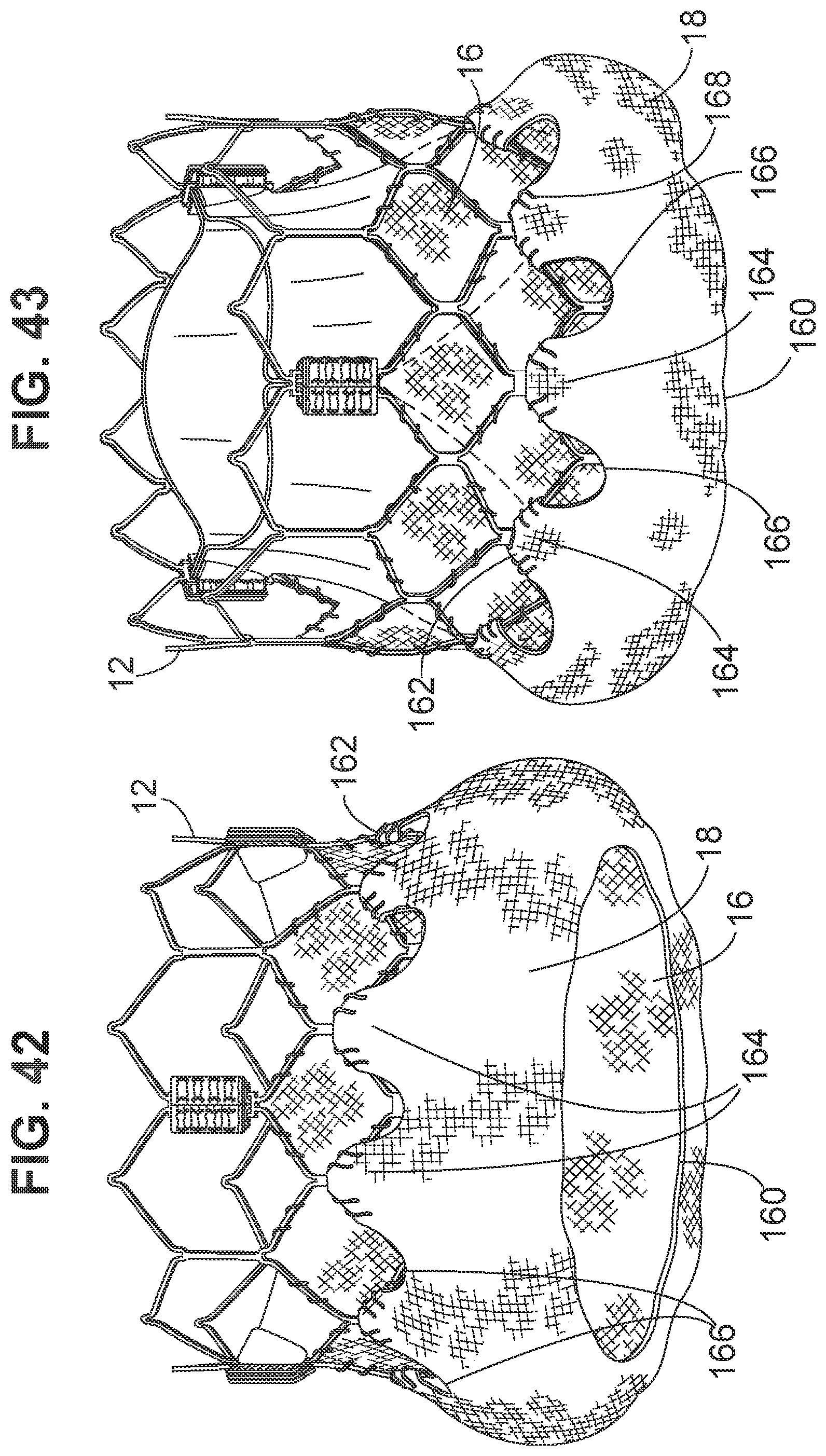 Patent US12102528 Figure 15 – Prosthetic heart valve