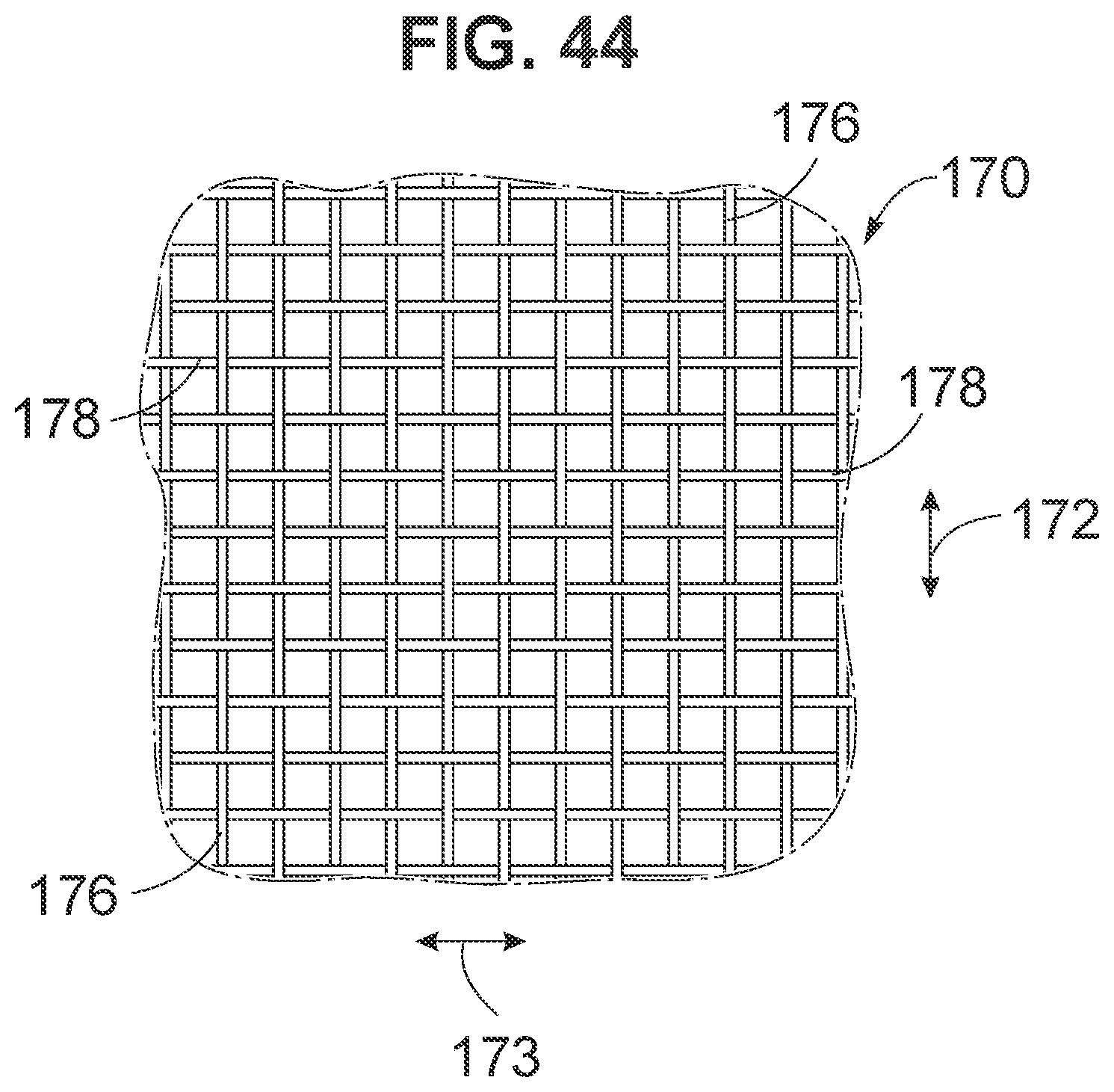 Patent US12102528 Figure 16 – Prosthetic heart valve