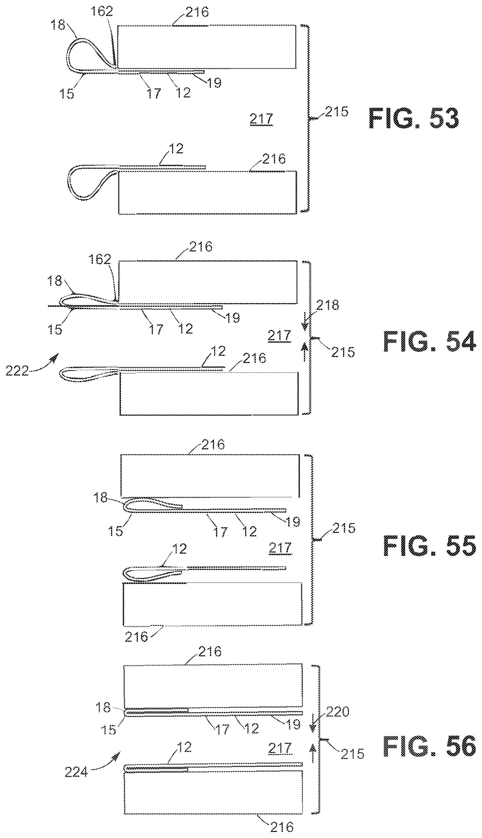 Patent US12102528 Figure 20 – Prosthetic heart valve