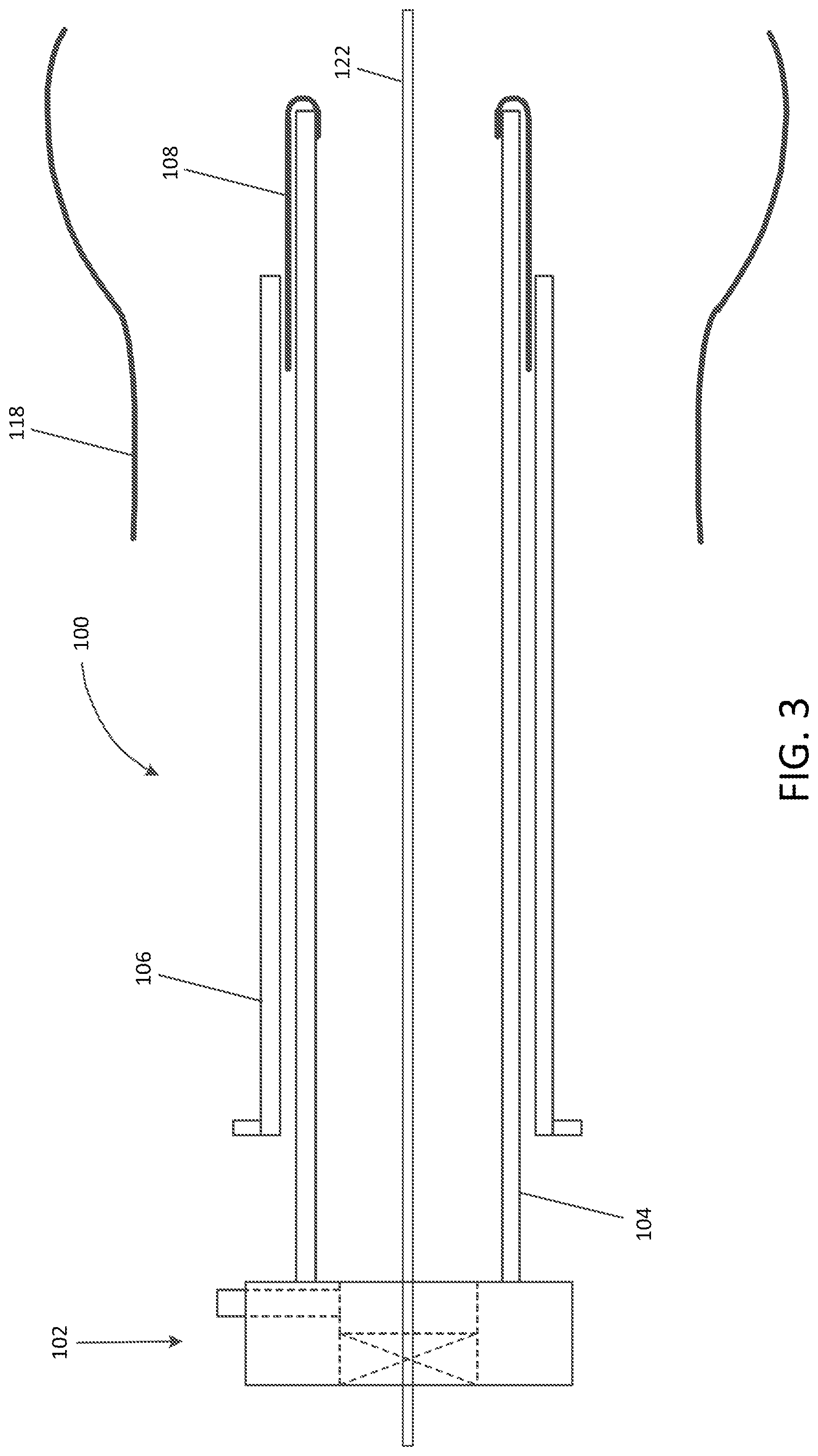 Patent US12102529 Figure 3 – Valve replacement devices and methods