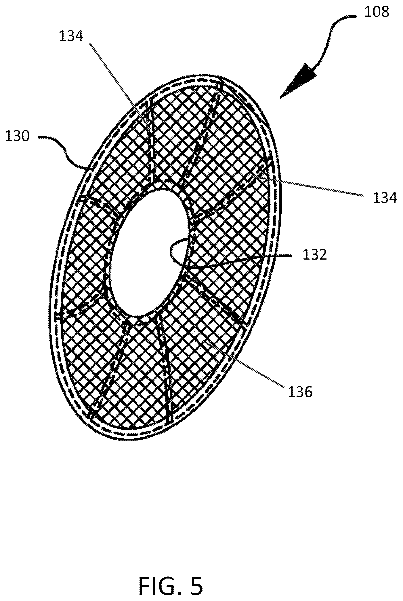 Patent US12102529 Figure 5 – Valve replacement devices and methods