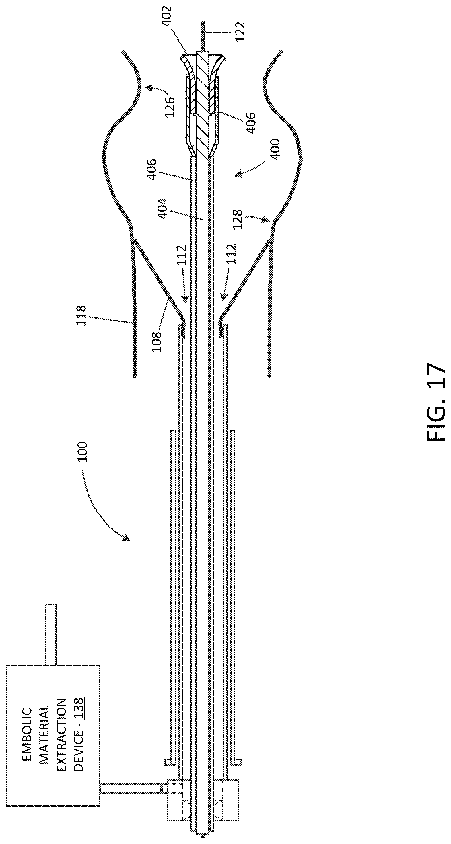 Patent US12102529 Figure 17 – Valve replacement devices and methods