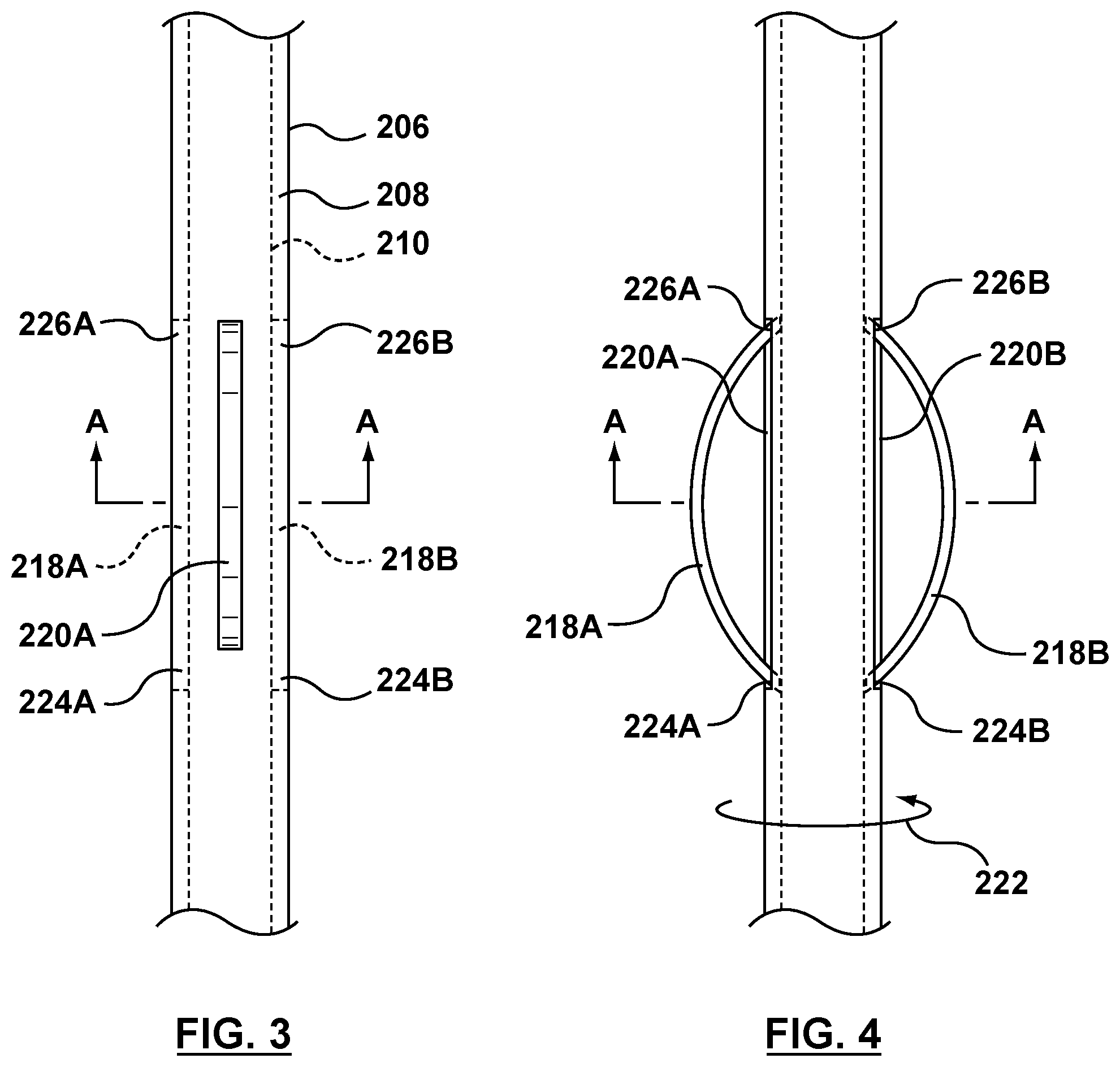 Patent US12102530 Figure 3 – Delivery system having an integral centering mechanism for positioning a valve prosthesis in situ