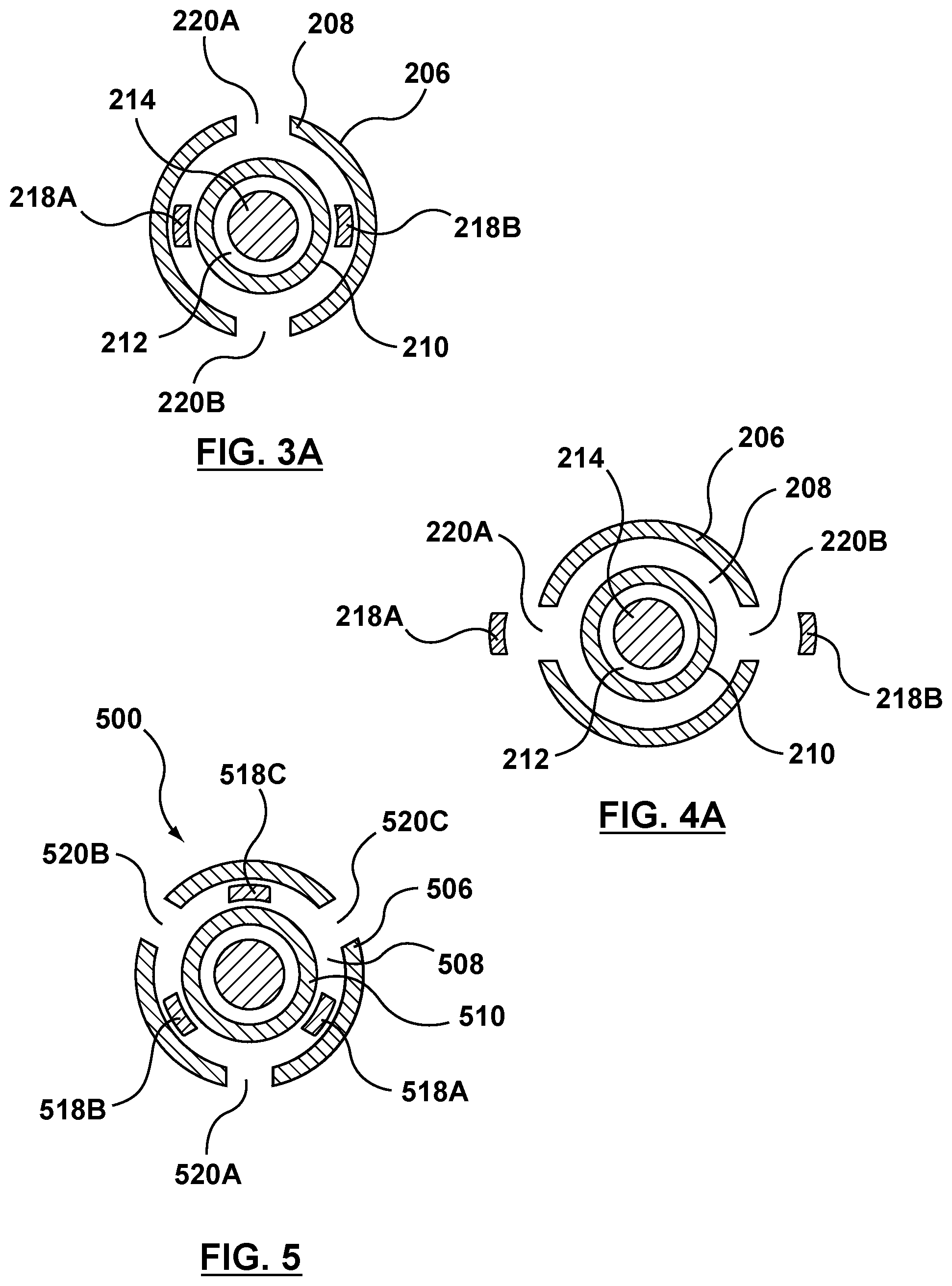 Patent US12102530 Figure 4 – Delivery system having an integral centering mechanism for positioning a valve prosthesis in situ