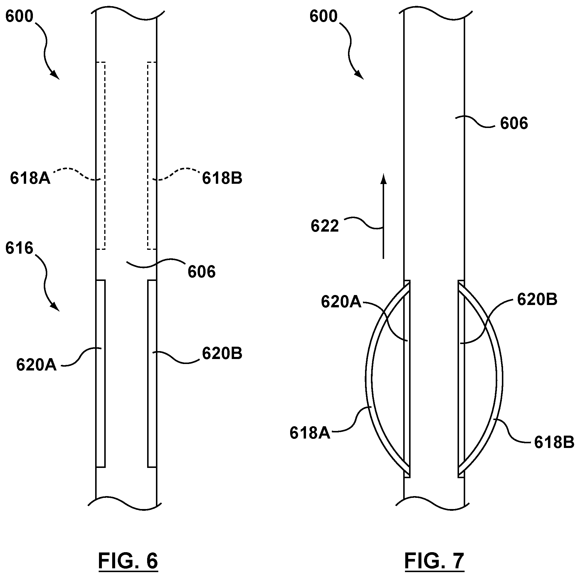 Patent US12102530 Figure 5 – Delivery system having an integral centering mechanism for positioning a valve prosthesis in situ