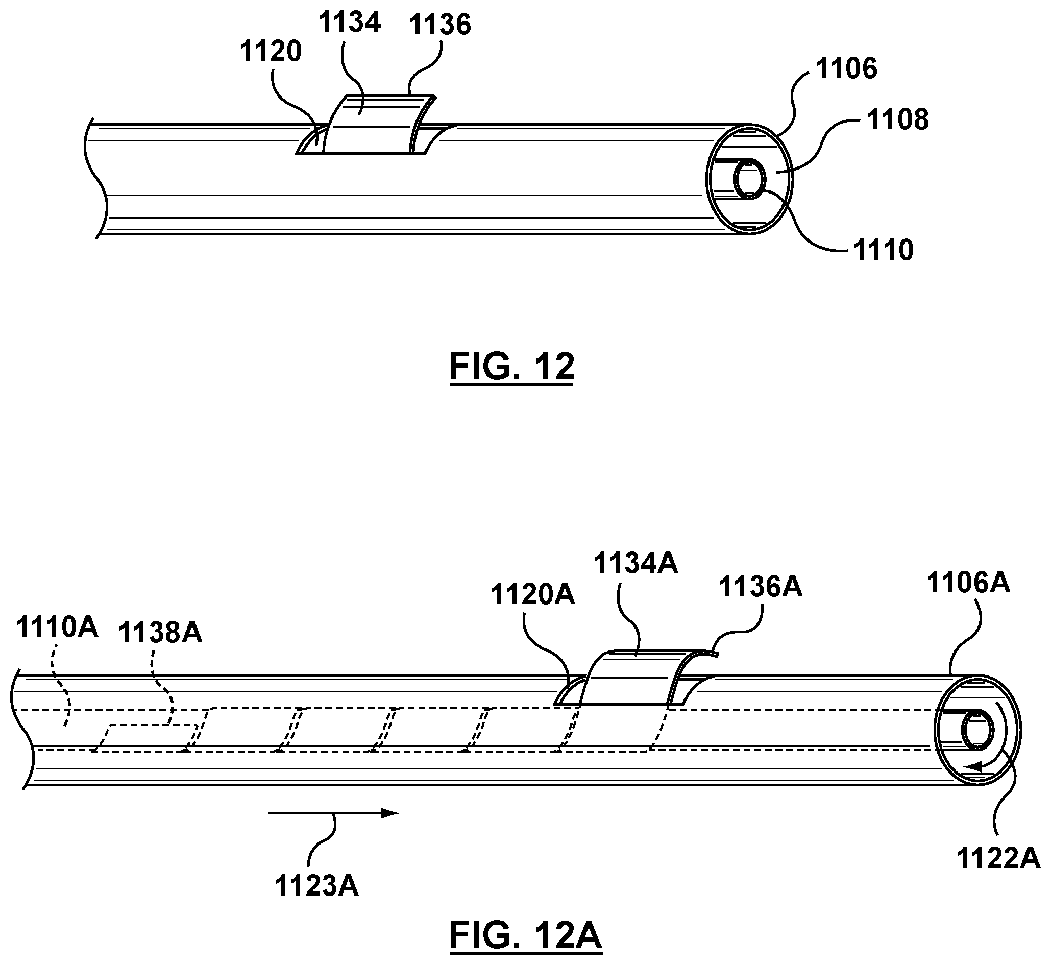 Patent US12102530 Figure 9 – Delivery system having an integral centering mechanism for positioning a valve prosthesis in situ