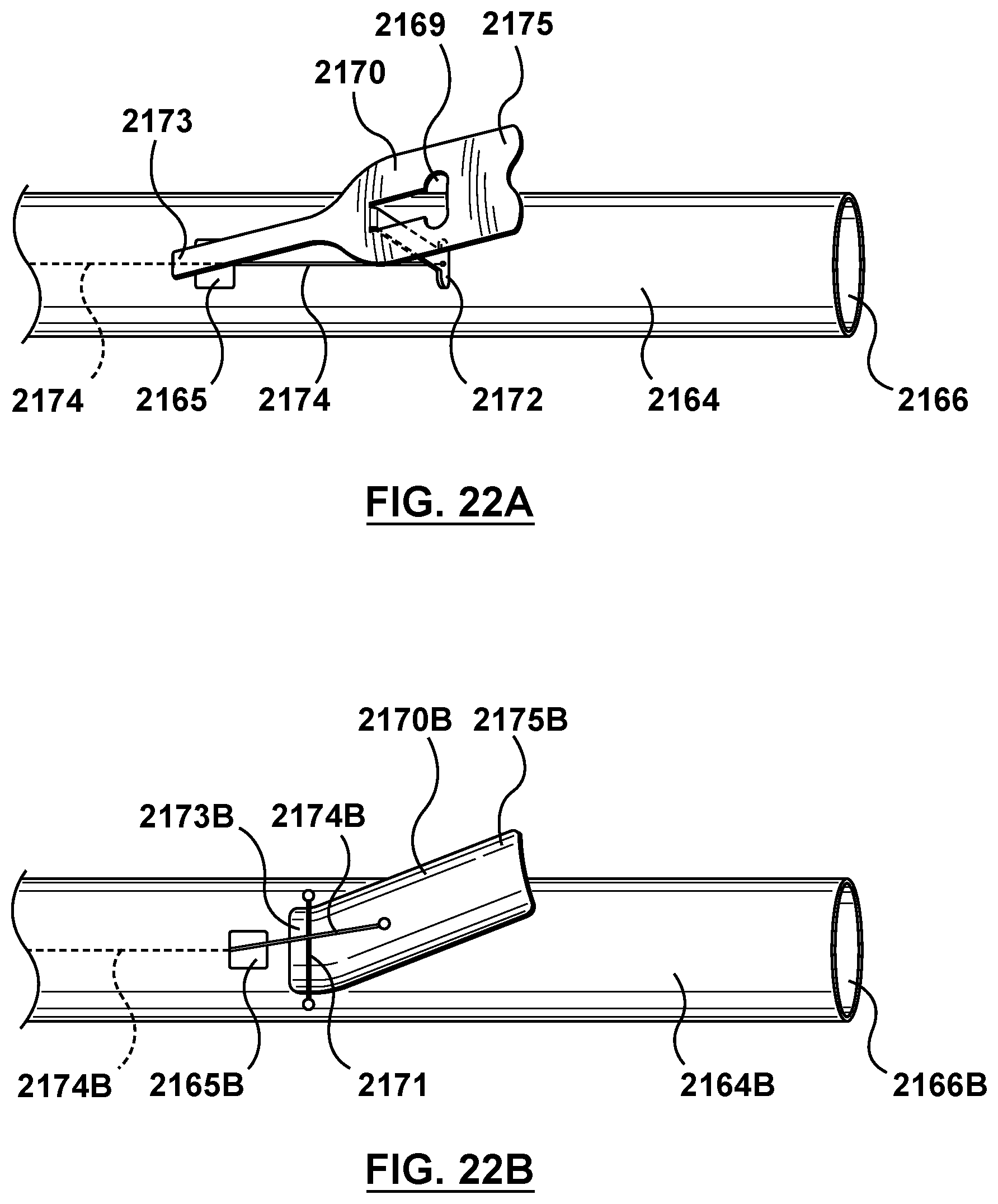Patent US12102530 Figure 20 – Delivery system having an integral centering mechanism for positioning a valve prosthesis in situ