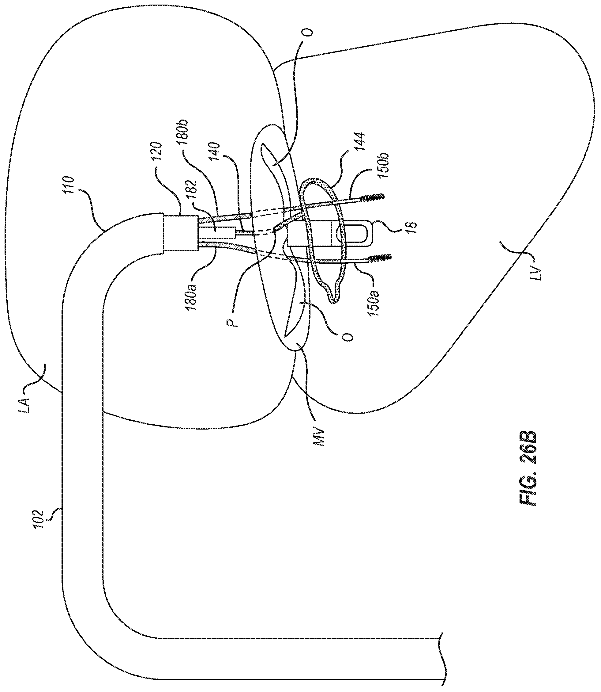 Patent US12102531 Figure 19 – Tissue cutting systems, devices and methods
