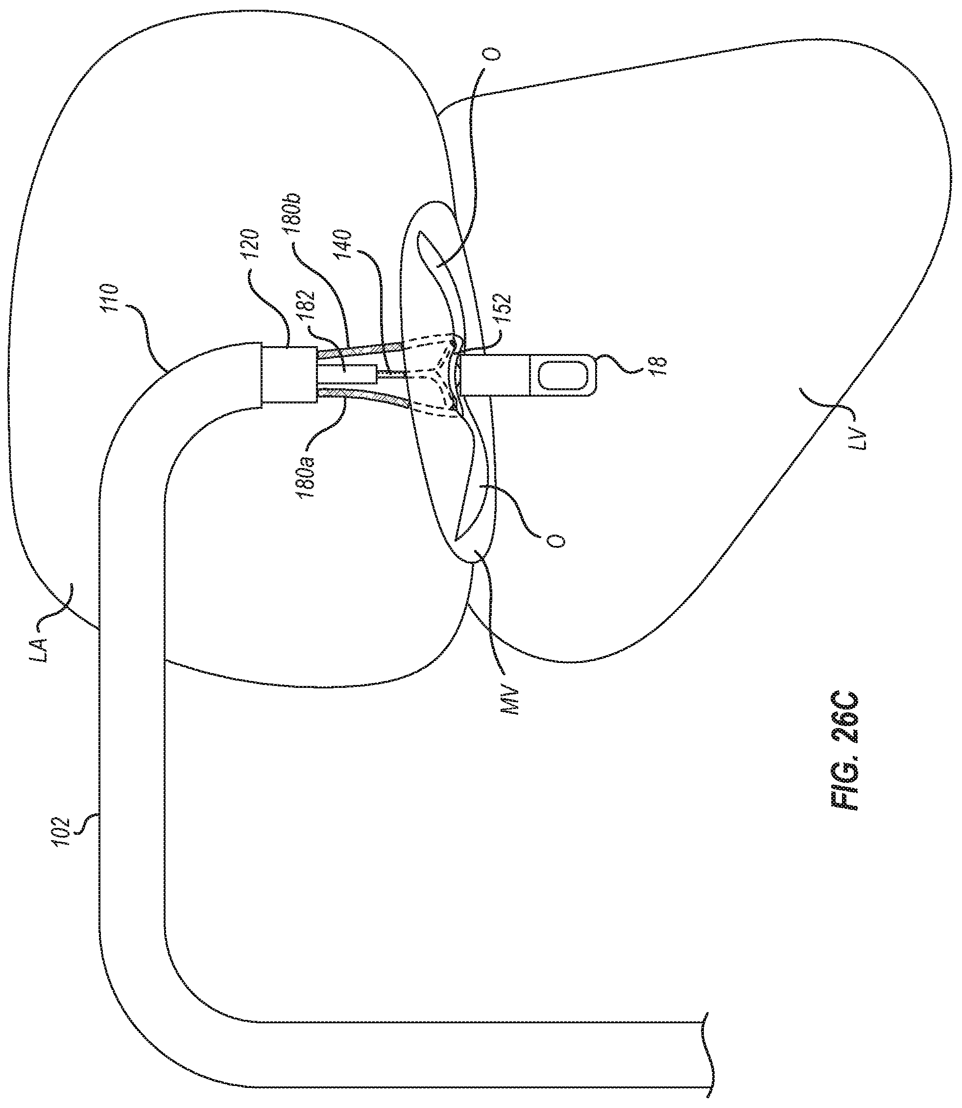 Patent US12102531 Figure 20 – Tissue cutting systems, devices and methods