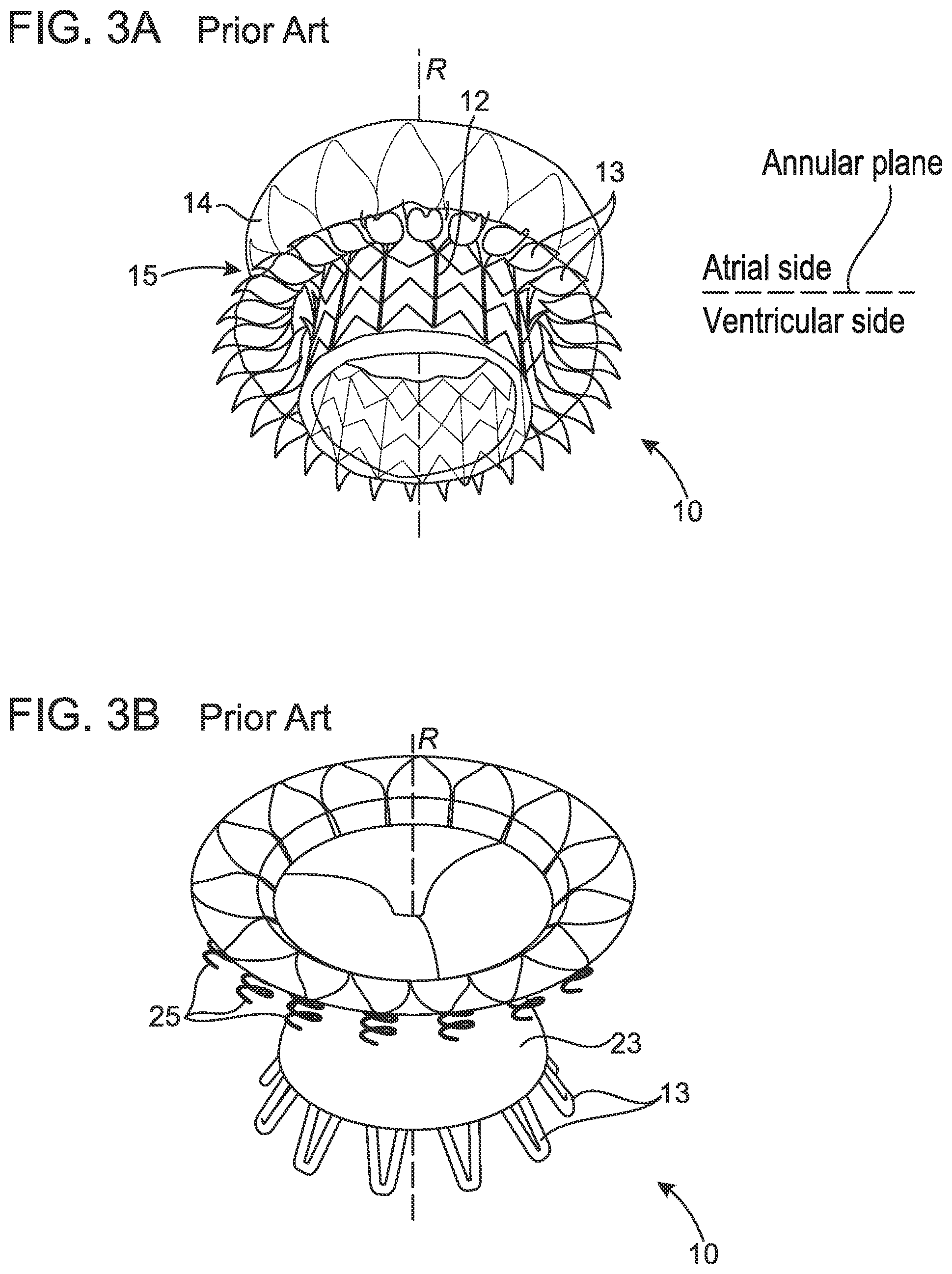Patent US12102532 Figure 2 – Systems and methods for treating luminal valves