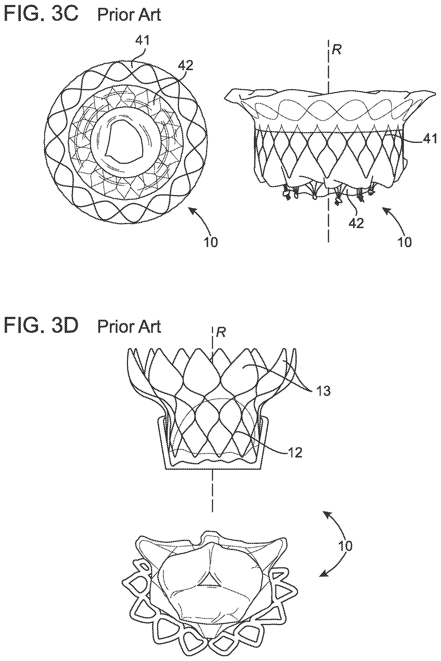 Patent US12102532 Figure 3 – Systems and methods for treating luminal valves