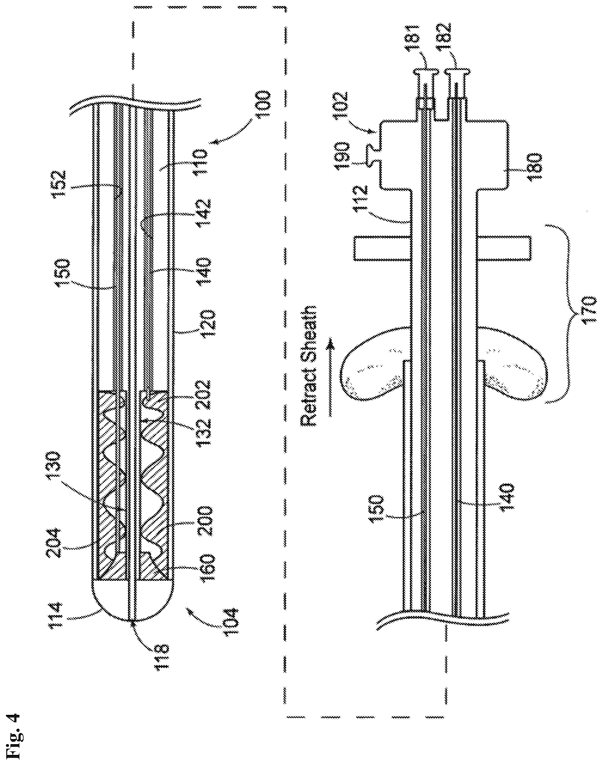 Patent US12102532 Figure 4 – Systems and methods for treating luminal valves