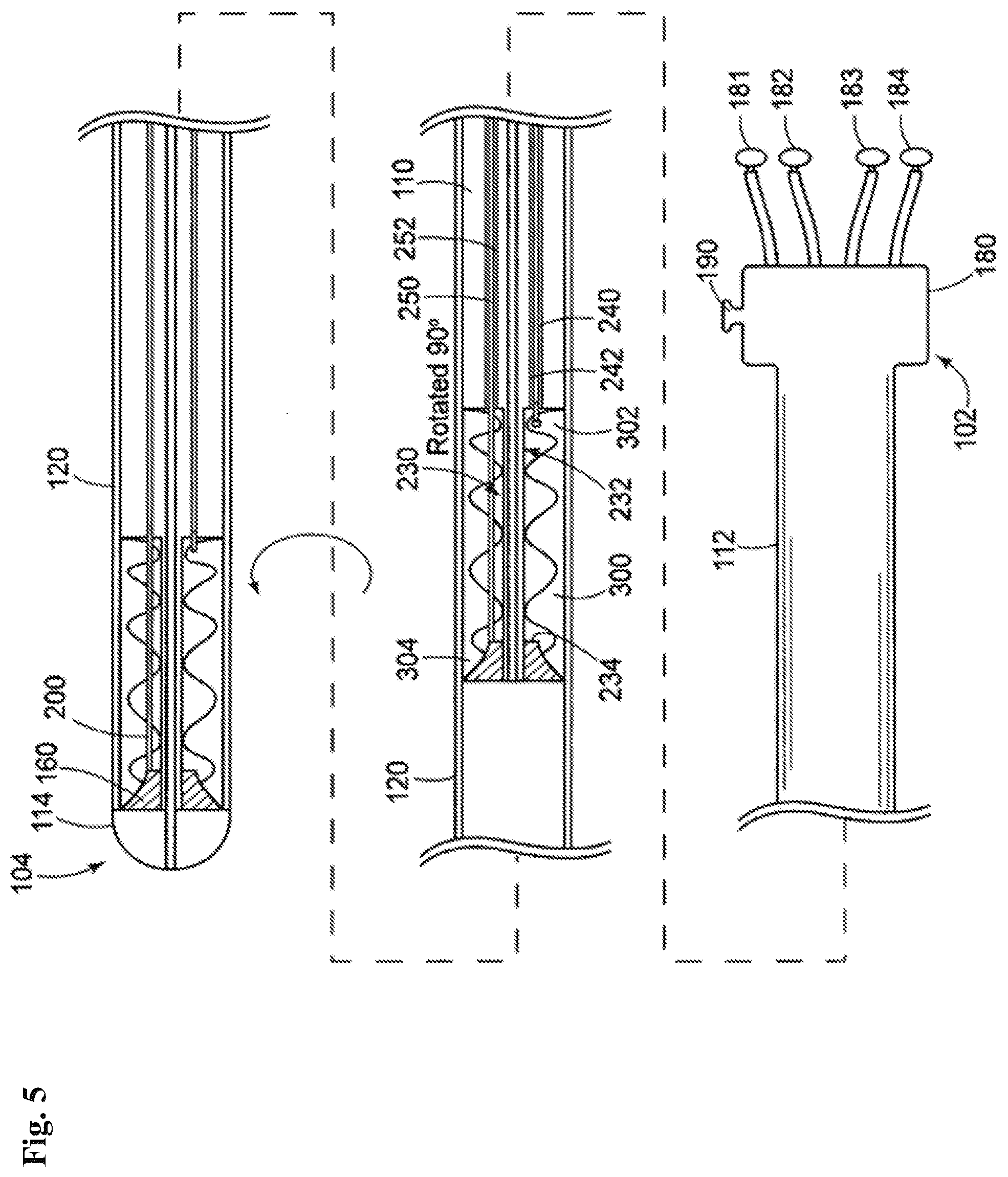 Patent US12102532 Figure 5 – Systems and methods for treating luminal valves