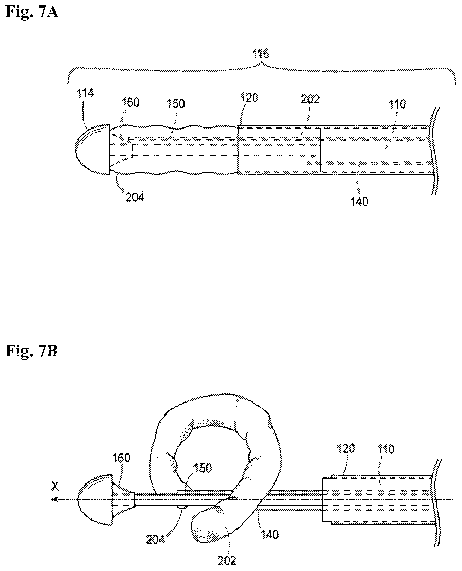 Patent US12102532 Figure 7 – Systems and methods for treating luminal valves